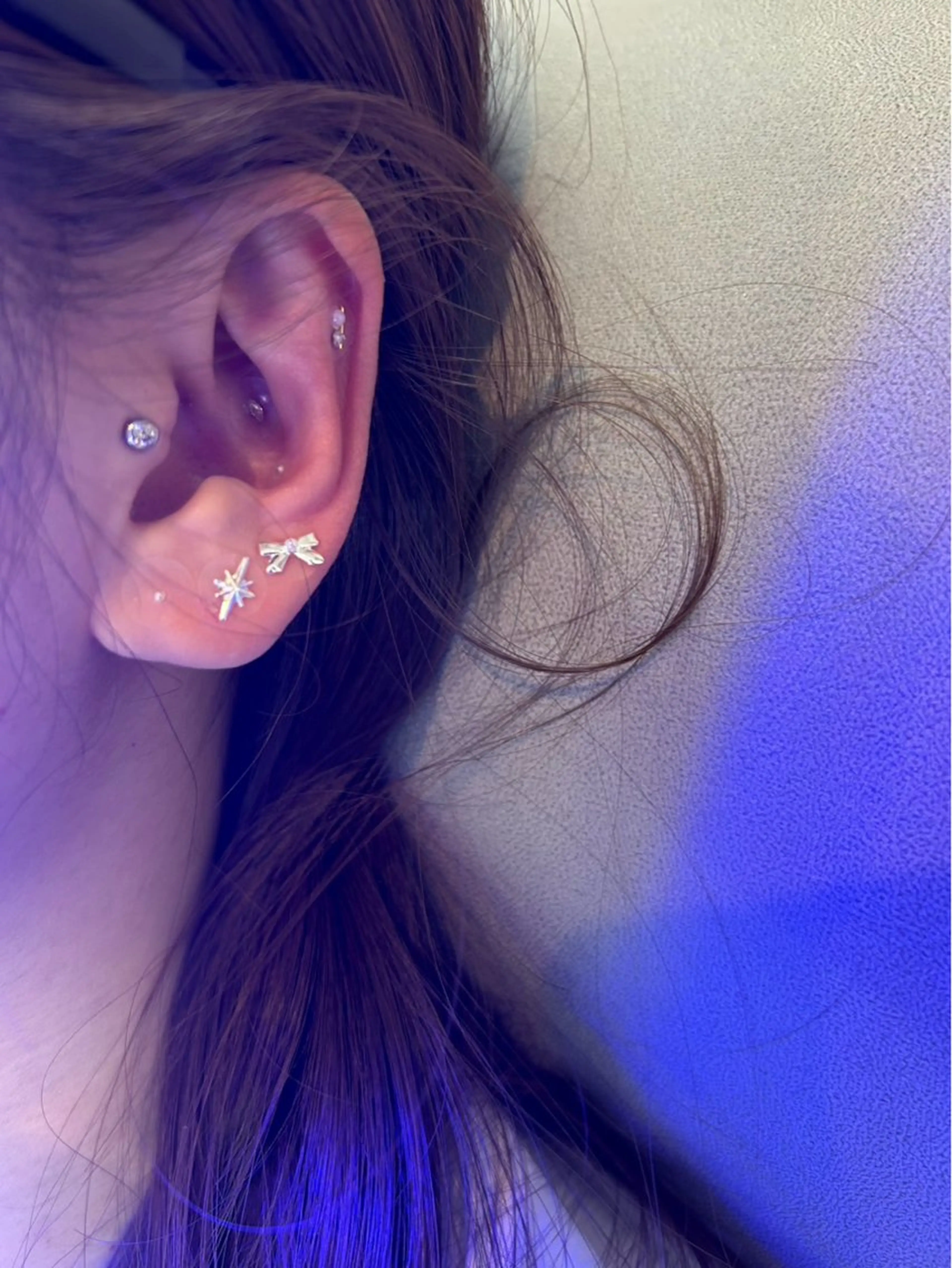 歯のセルフホワイトニング専門店GLOW（グロウ）所属・東区香椎歯のセルフホ ワイトニングGLOWのその他イメージ