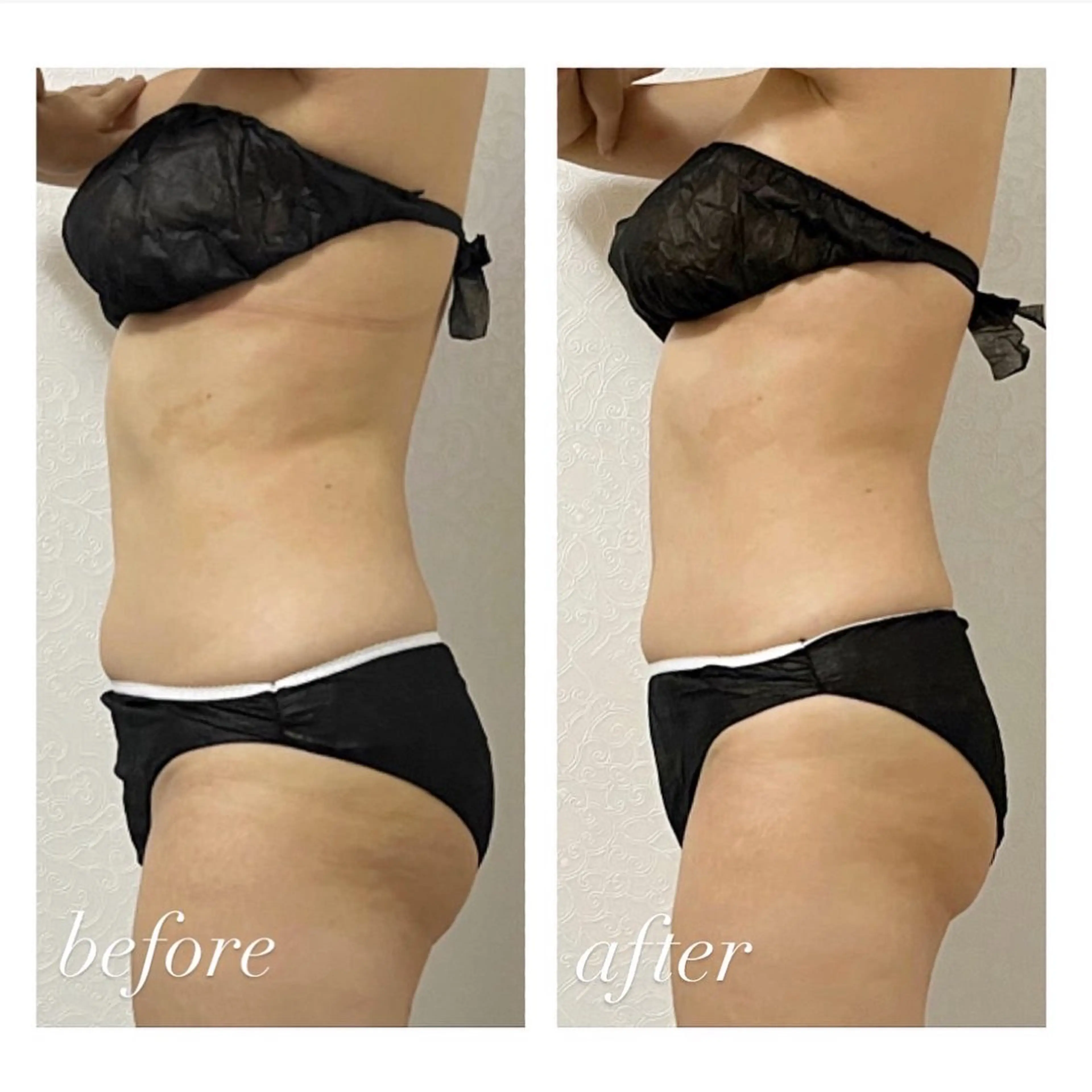 表参道エステサロン &BEAUTÉのエステ・リラクイメージ