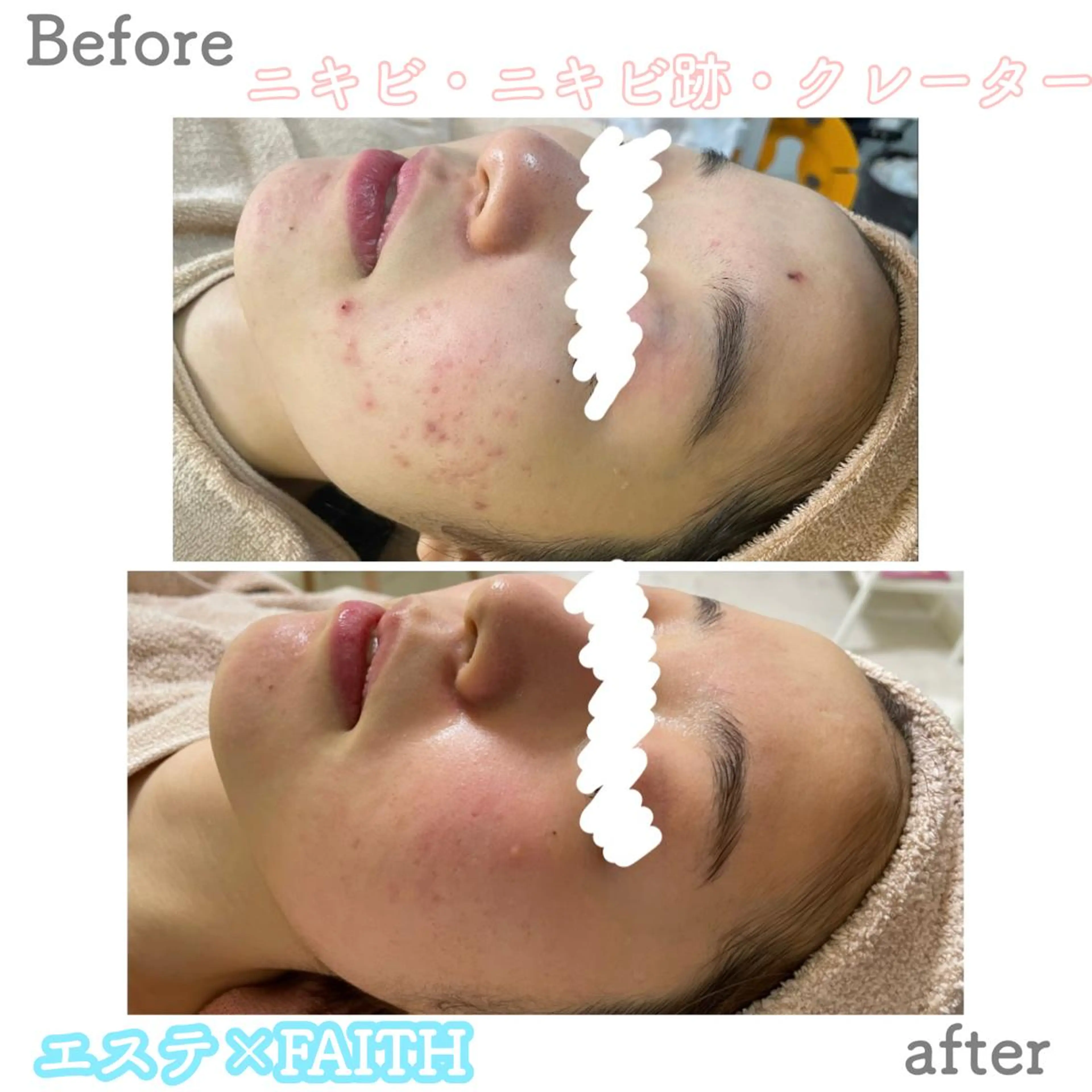 ミディアム カラー パーマ ヘアアレンジ キッズ ネイル マツエク・マツパ アイブロウ エステ ニキビ&跡改善サロン オーナー光木のエステ・リラクイメージ