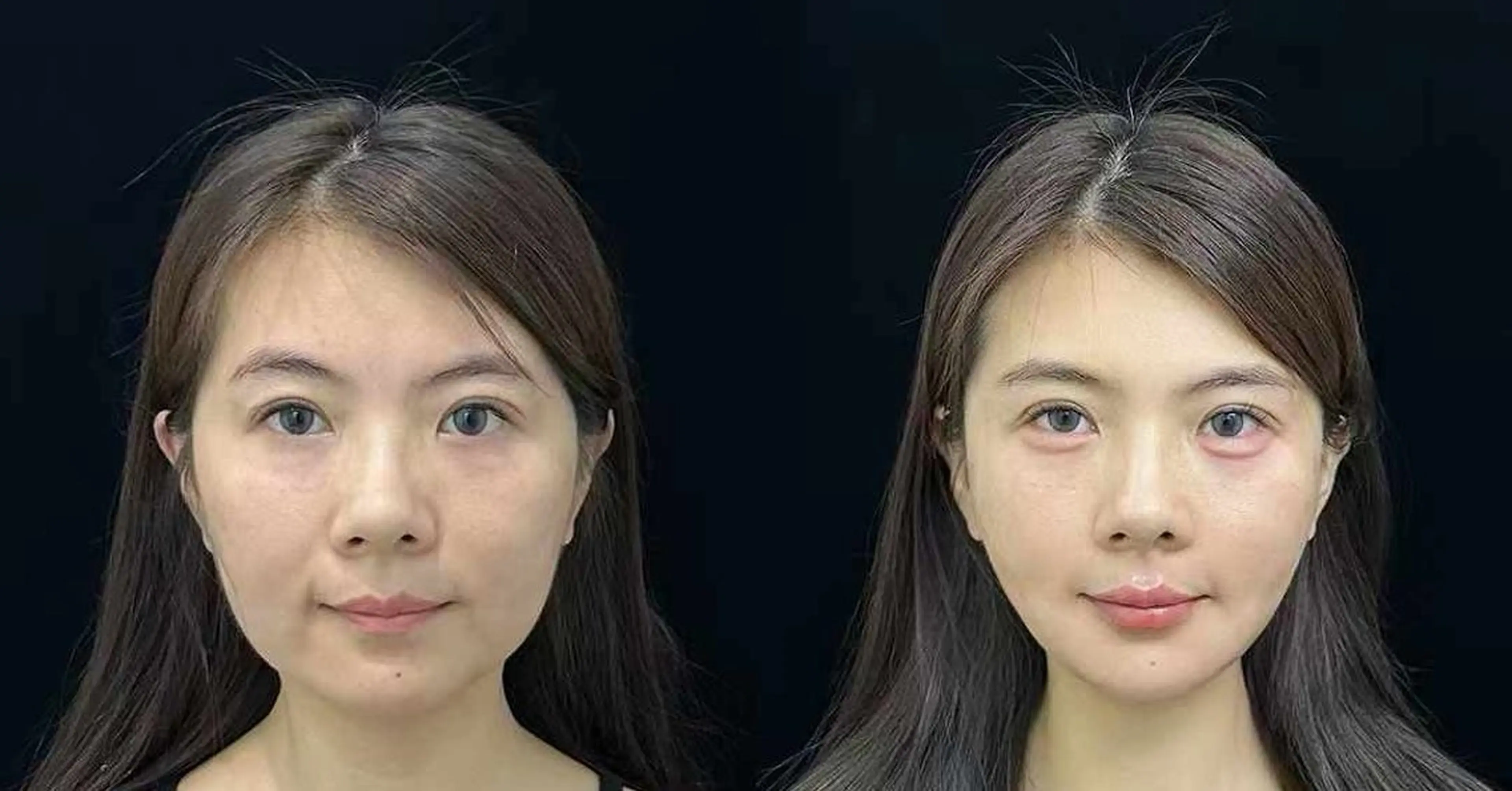 ネイル エステ aliaハイフ&水光ジェットサロン所属・aliaハーブ水光店 エステティシャン募集のエステ・リラクイメージ