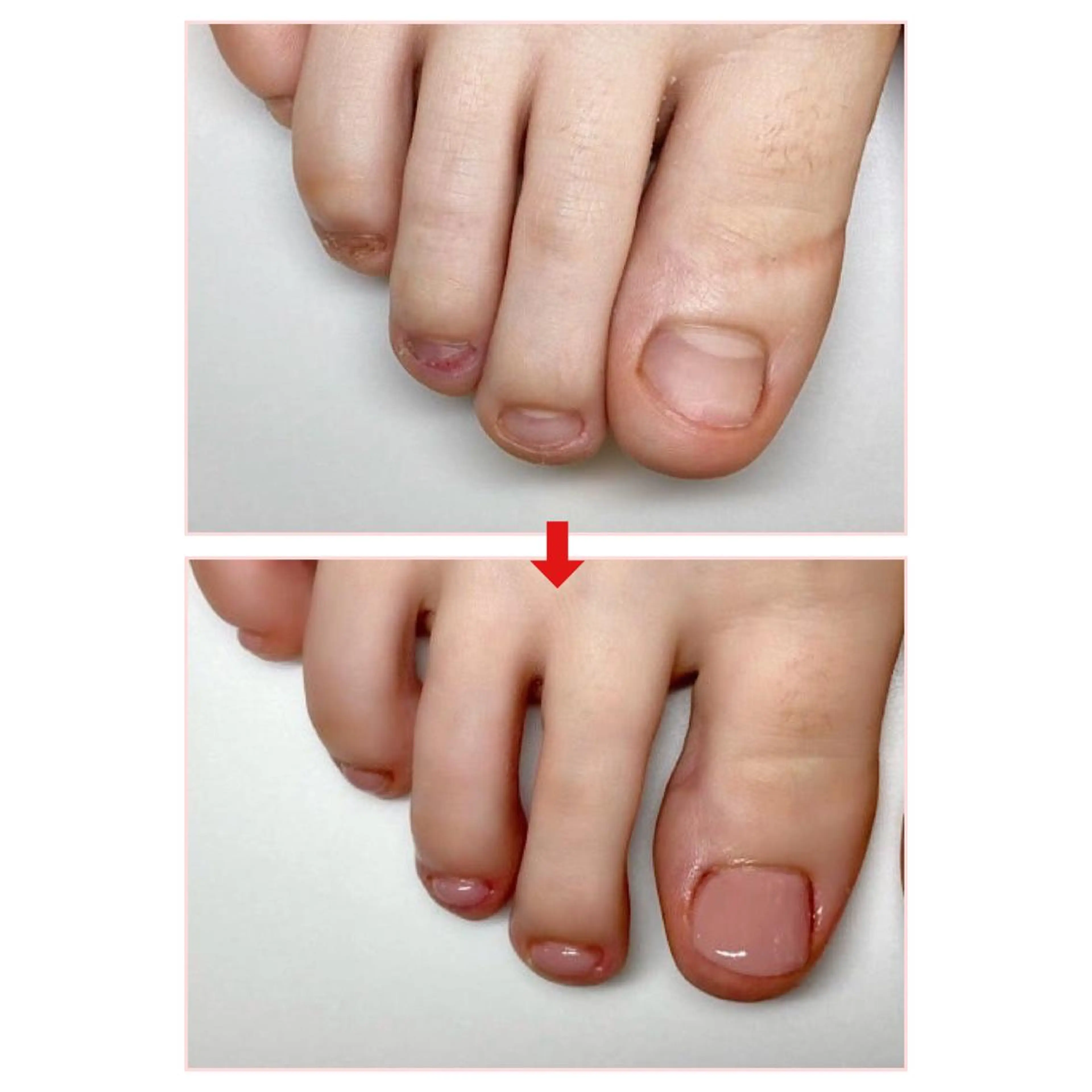 ネイル フットネイル ネイルサロンアリューム所属・ネイルサロン アリュームのネイルデザイン