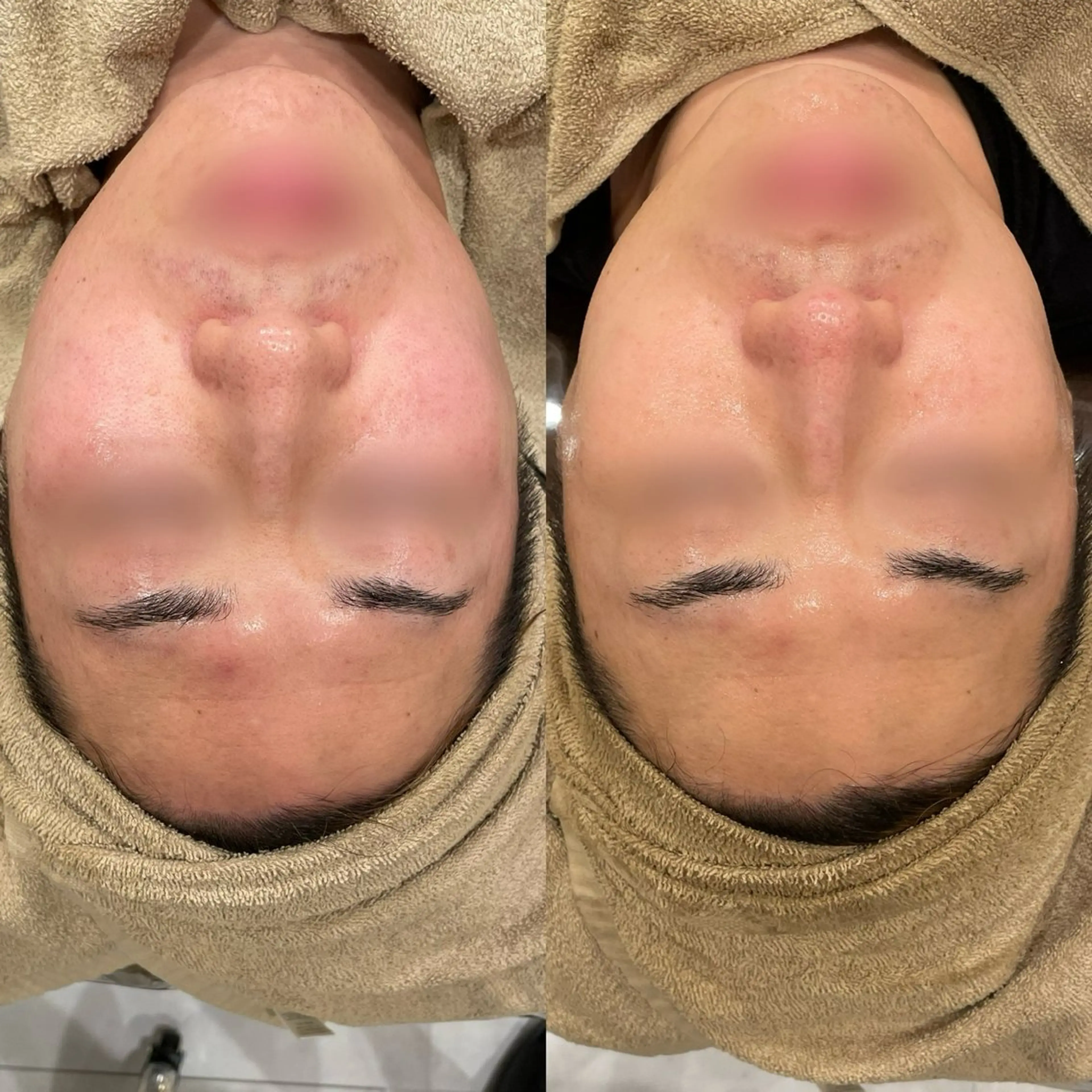 エステ Re:Belle所属・Re:Belle 久留米 : 中島のエステ・リラクイメージ