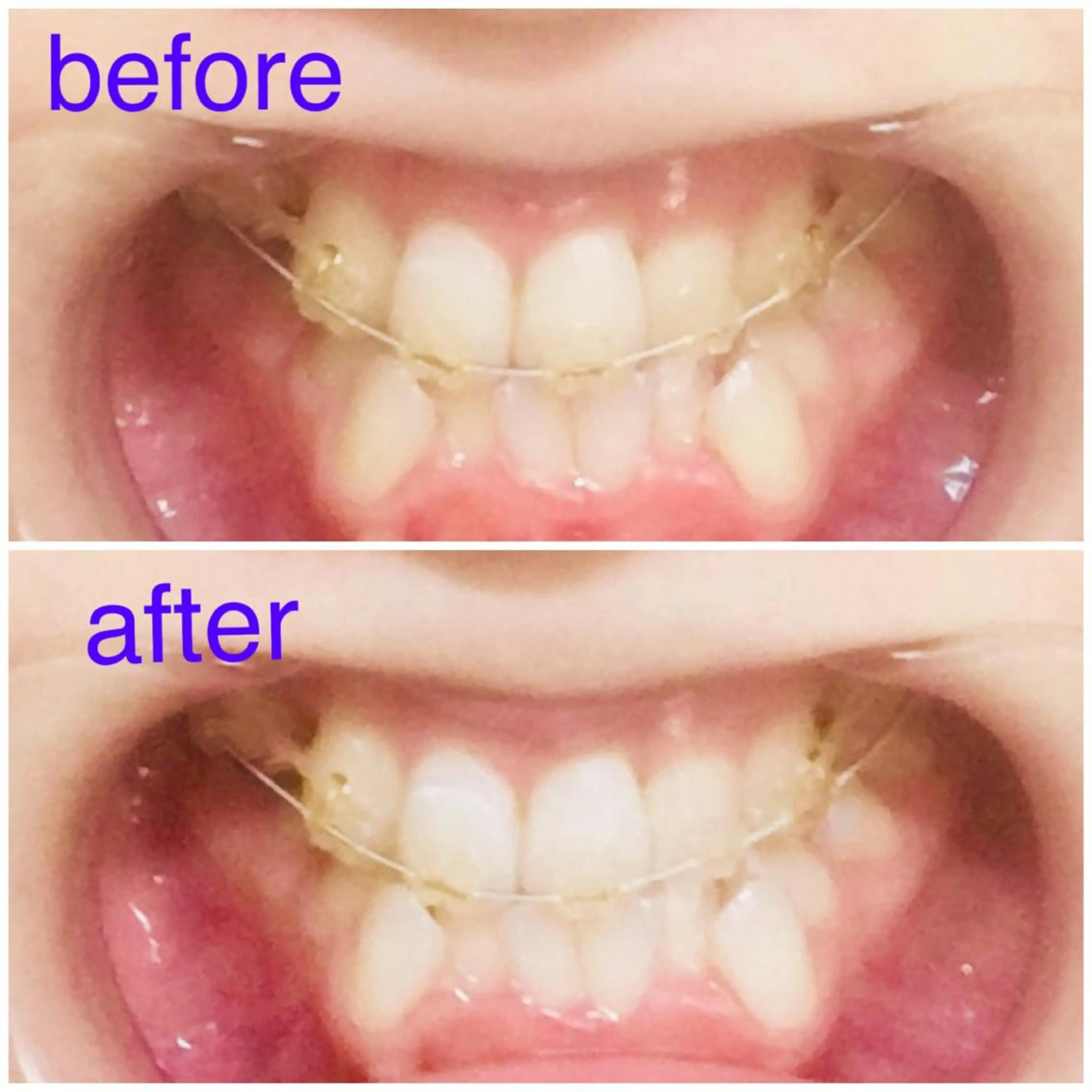 イーチブライト EachBrightのその他イメージ