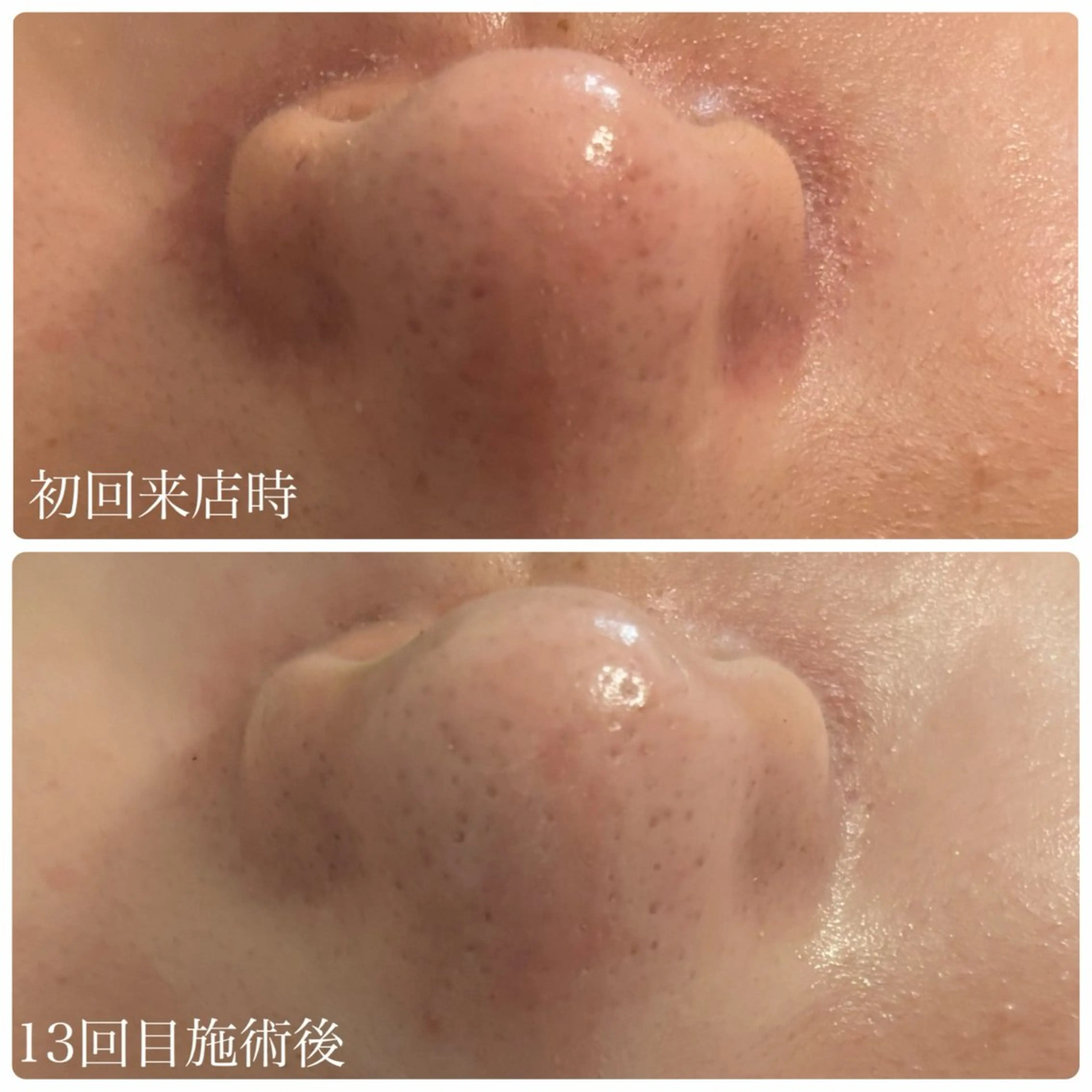 肌管理サロン Briller所属・肌管理サロン Briller 押上のエステ・リラクイメージ