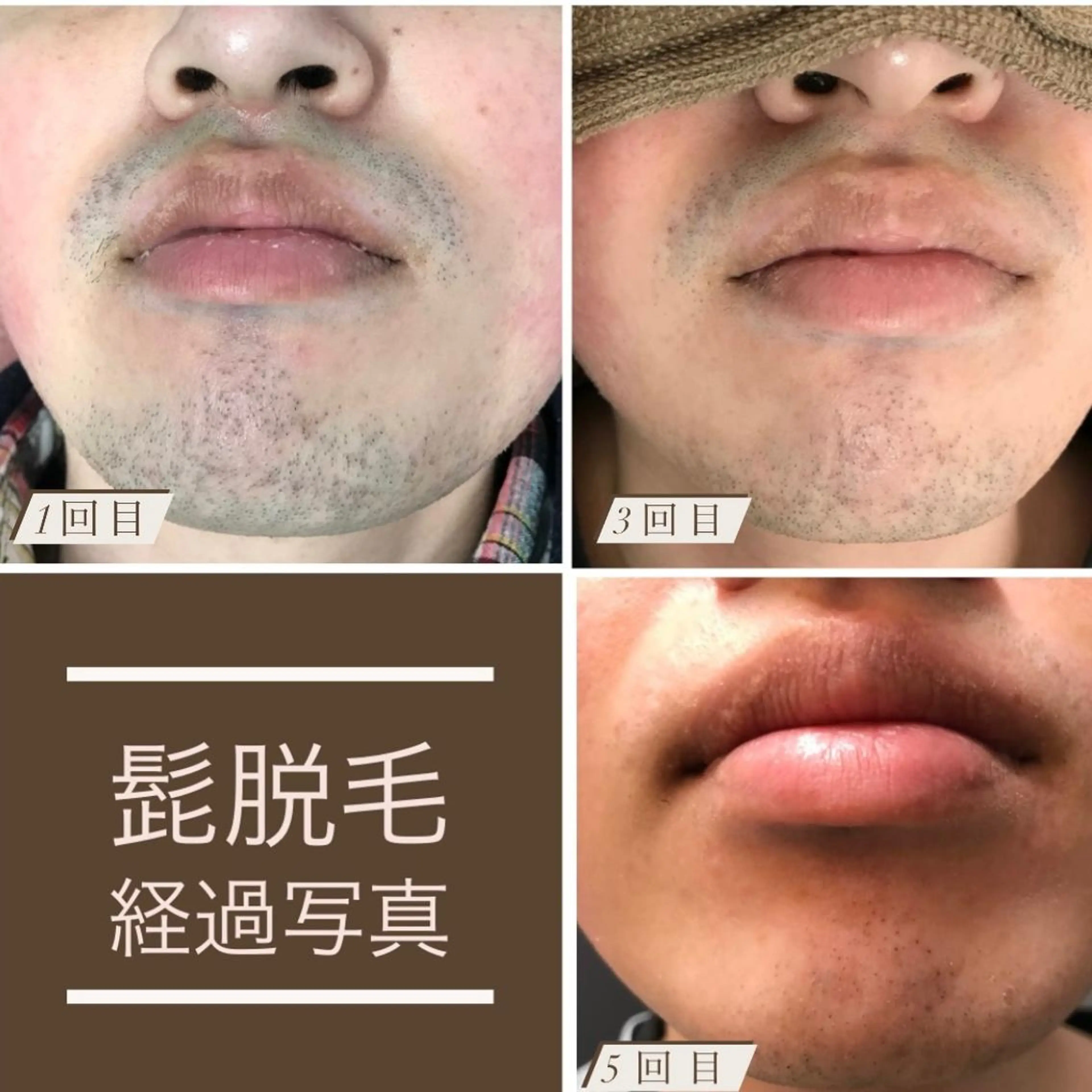 メンズ Lilyboo 池袋のエステ・リラクイメージ