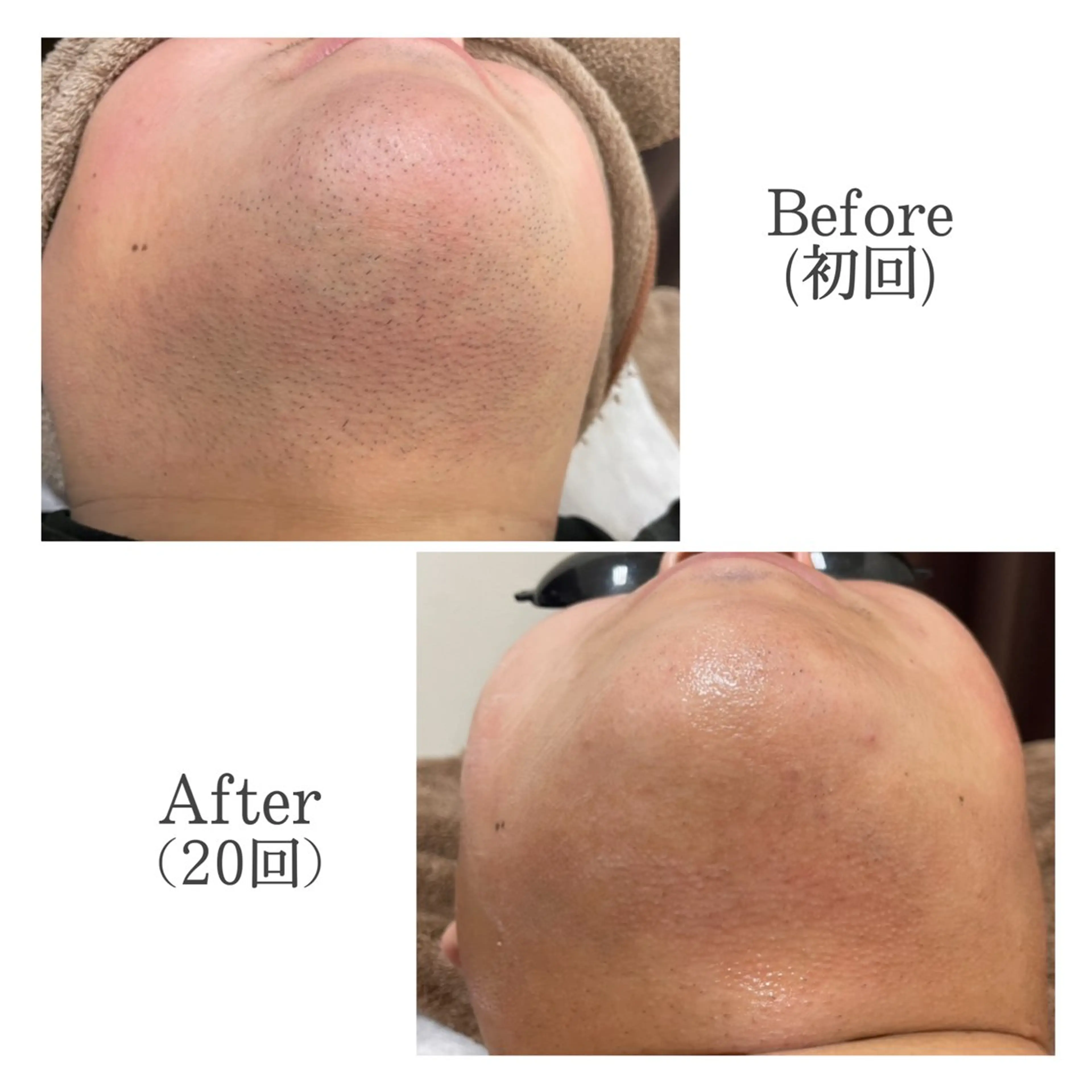 Folche所属・菊地 そらのエステ・リラクイメージ