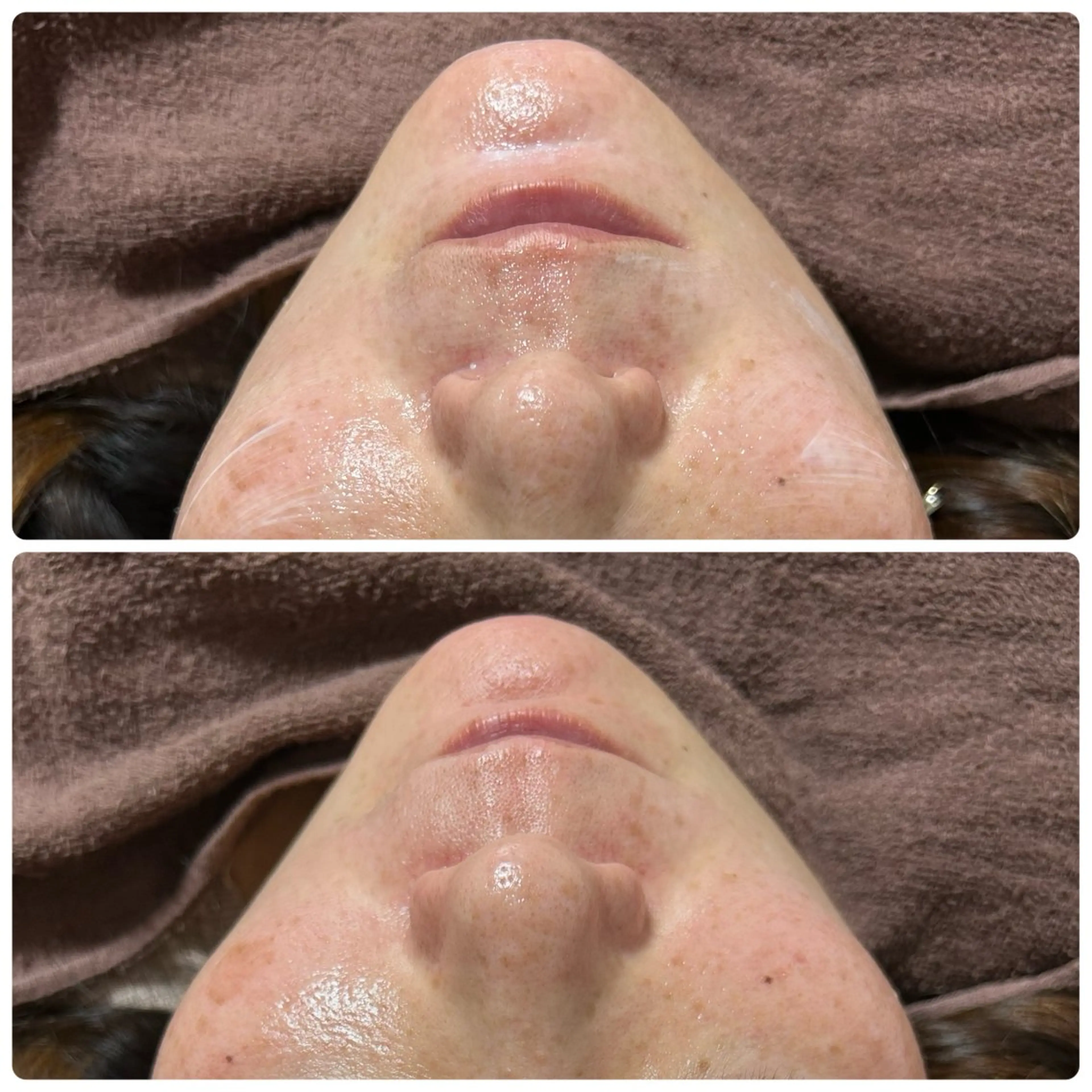 エステ Lala nailのネイルデザイン