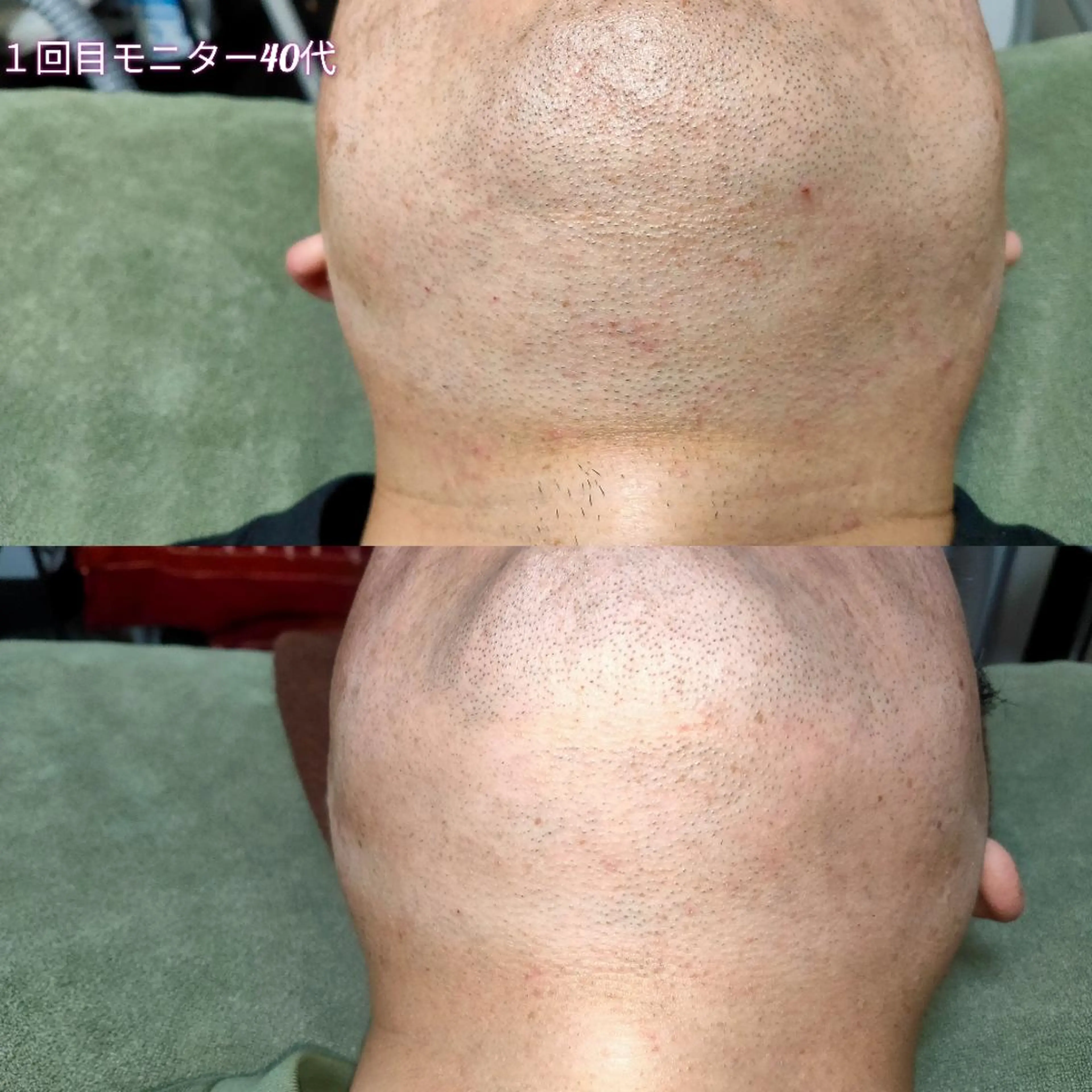 メンズ 脱毛 武 藤のエステ・リラクイメージ