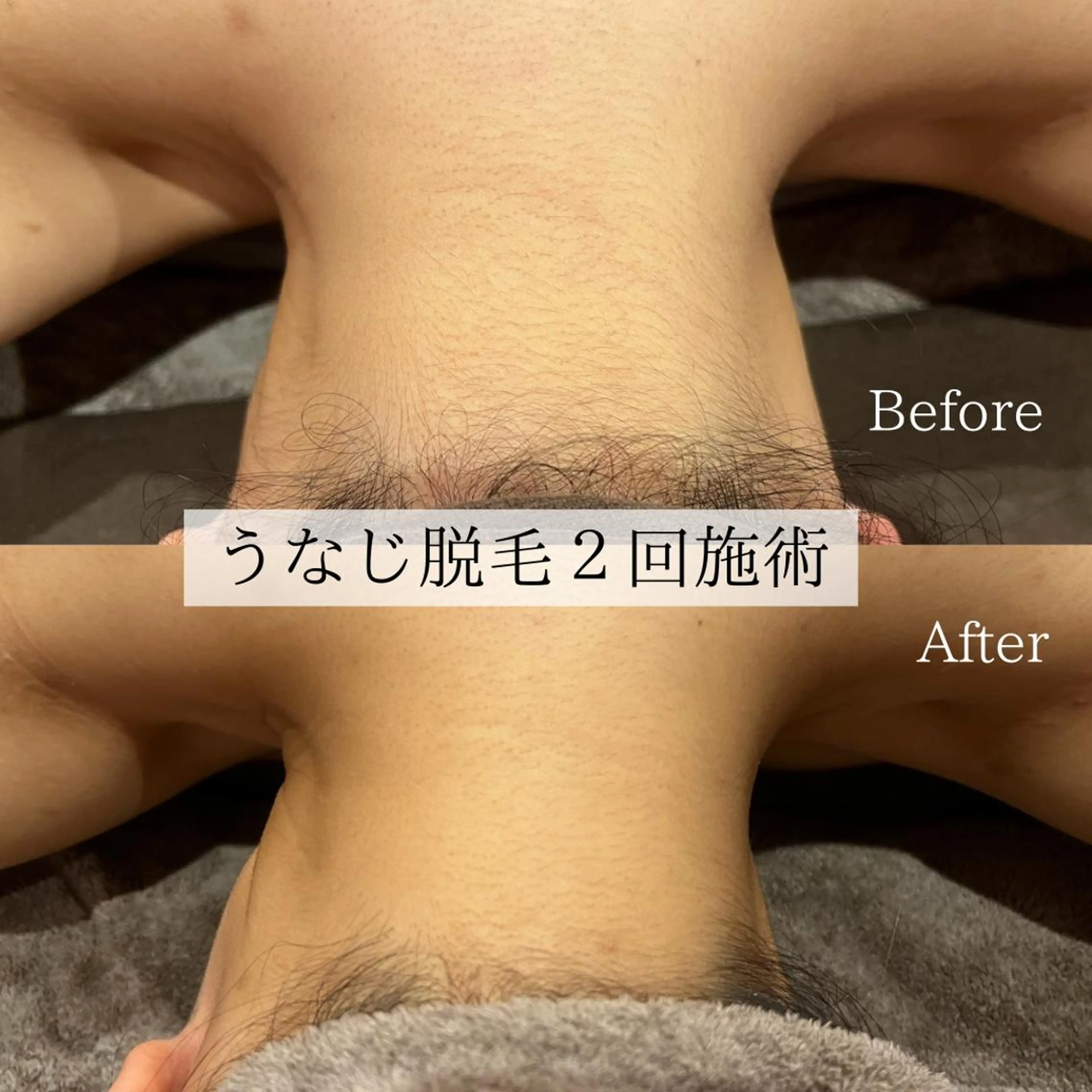 小顔美肌：ミアンカ 京阪モール本館1Fのエステ・リラクイメージ