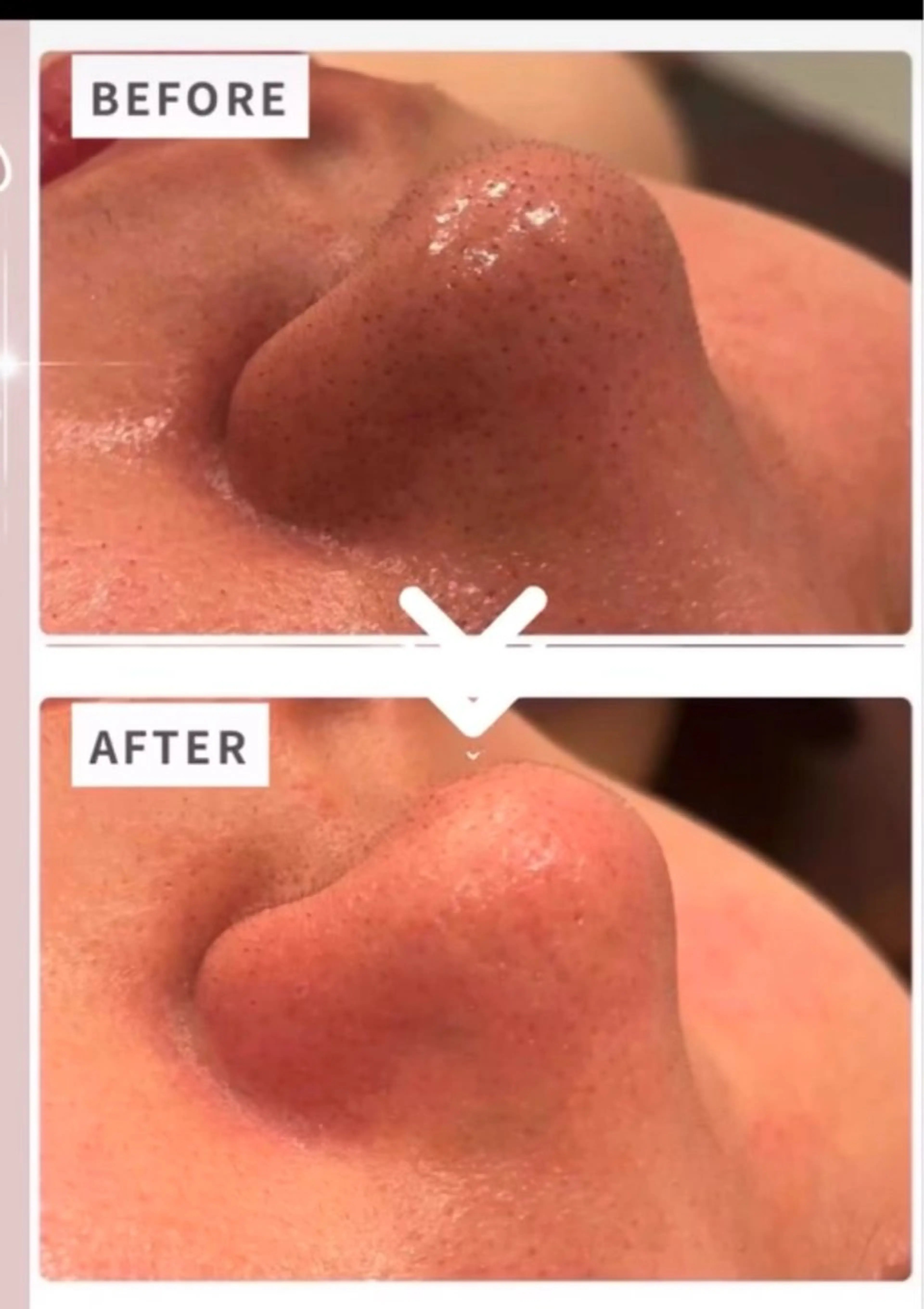 🦋肌改善 laule'a🦋のエステ・リラクイメージ