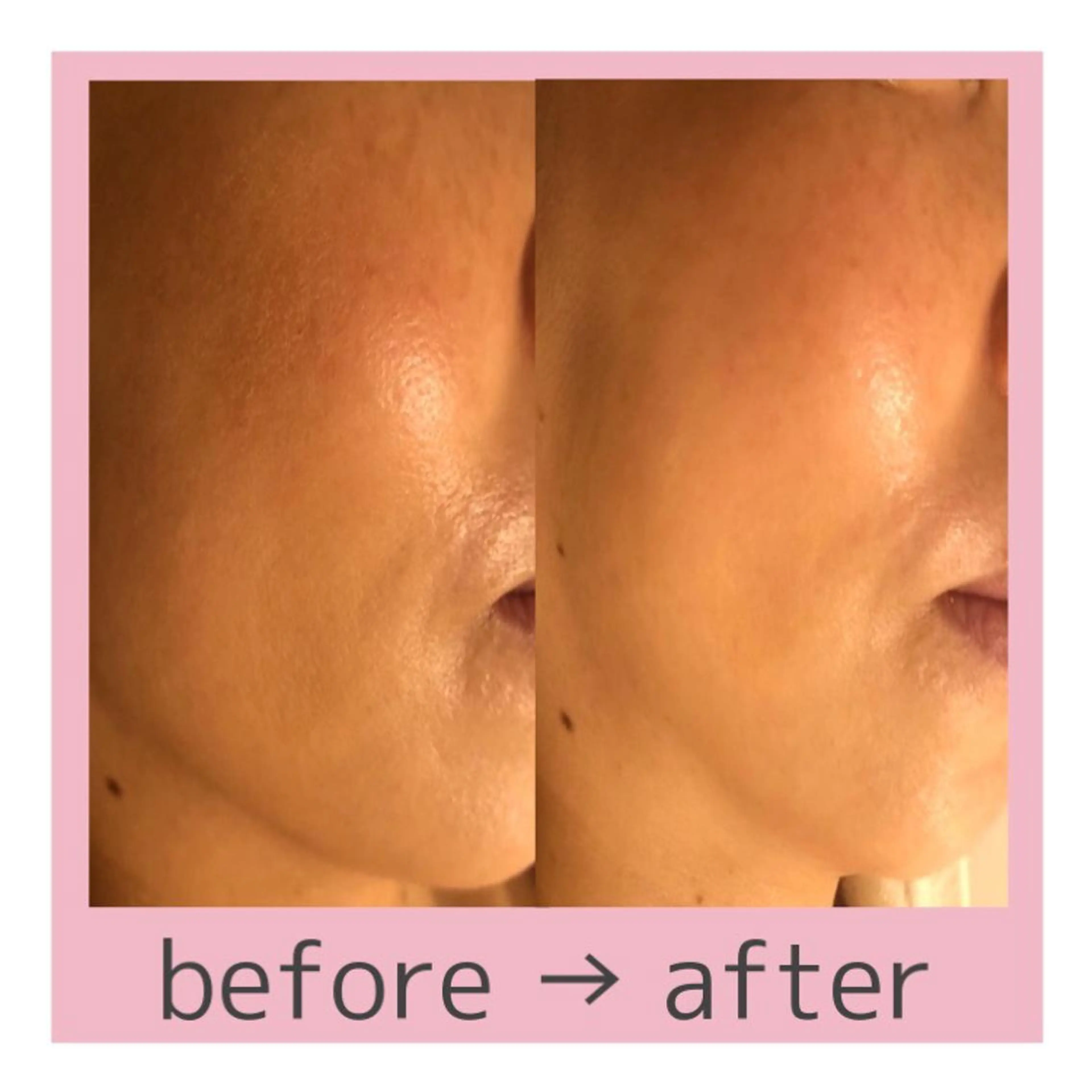 リラク 大人の 毛穴ケア専門店のその他イメージ