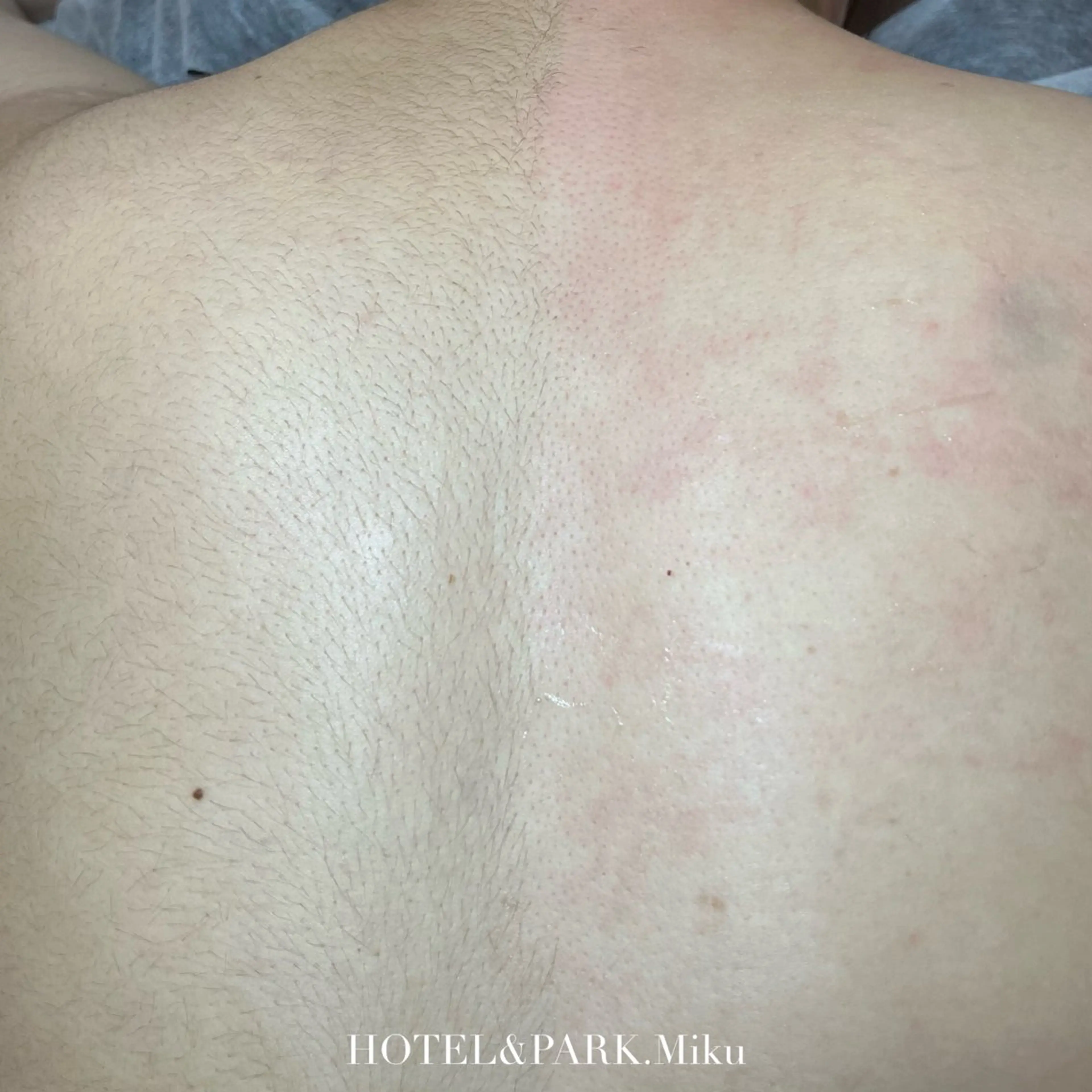 HOTEL&PARK Mikuワックス脱毛のエステ・リラクイメージ