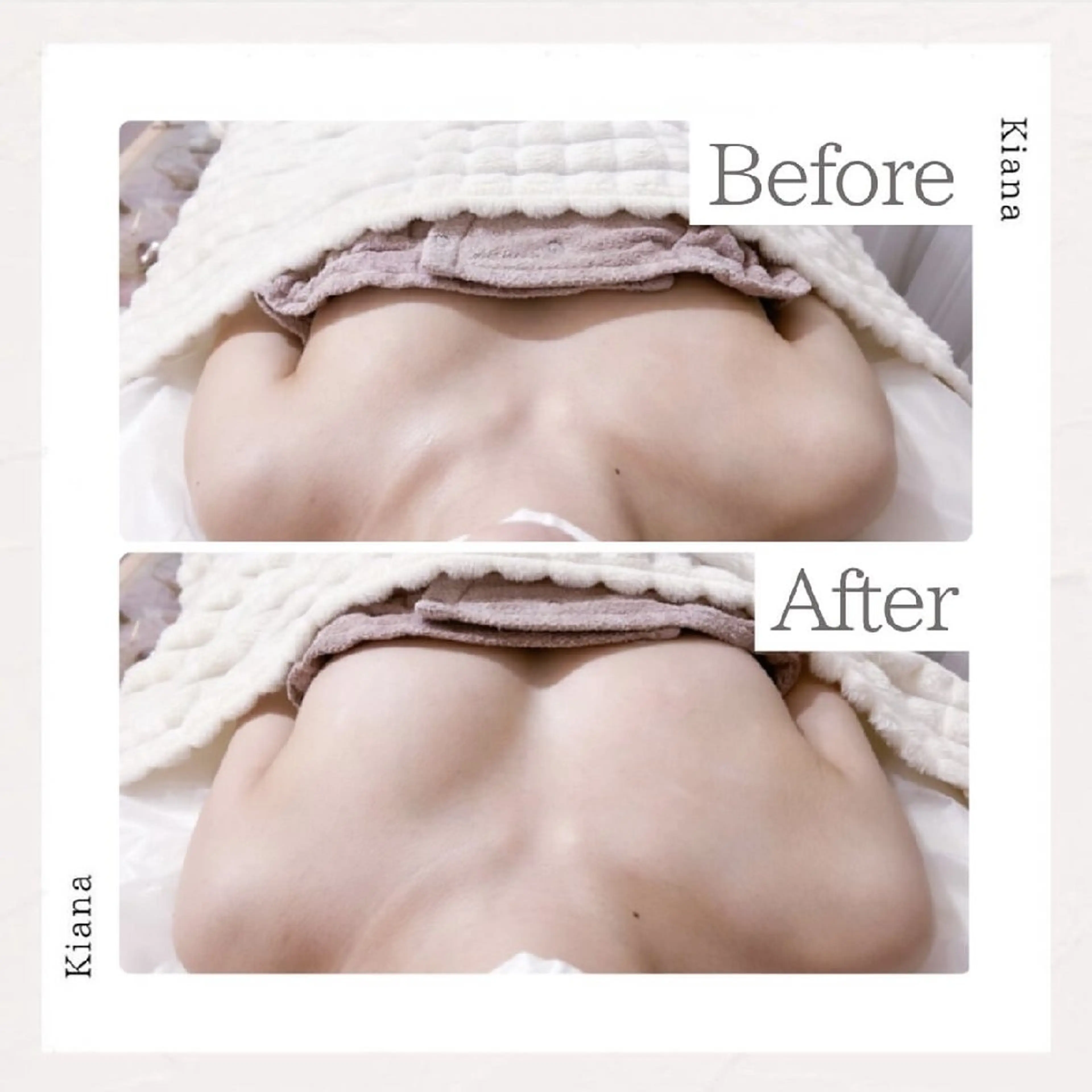 エステ リラク 【バスト専門店 】 Kiana のエステ・リラクイメージ