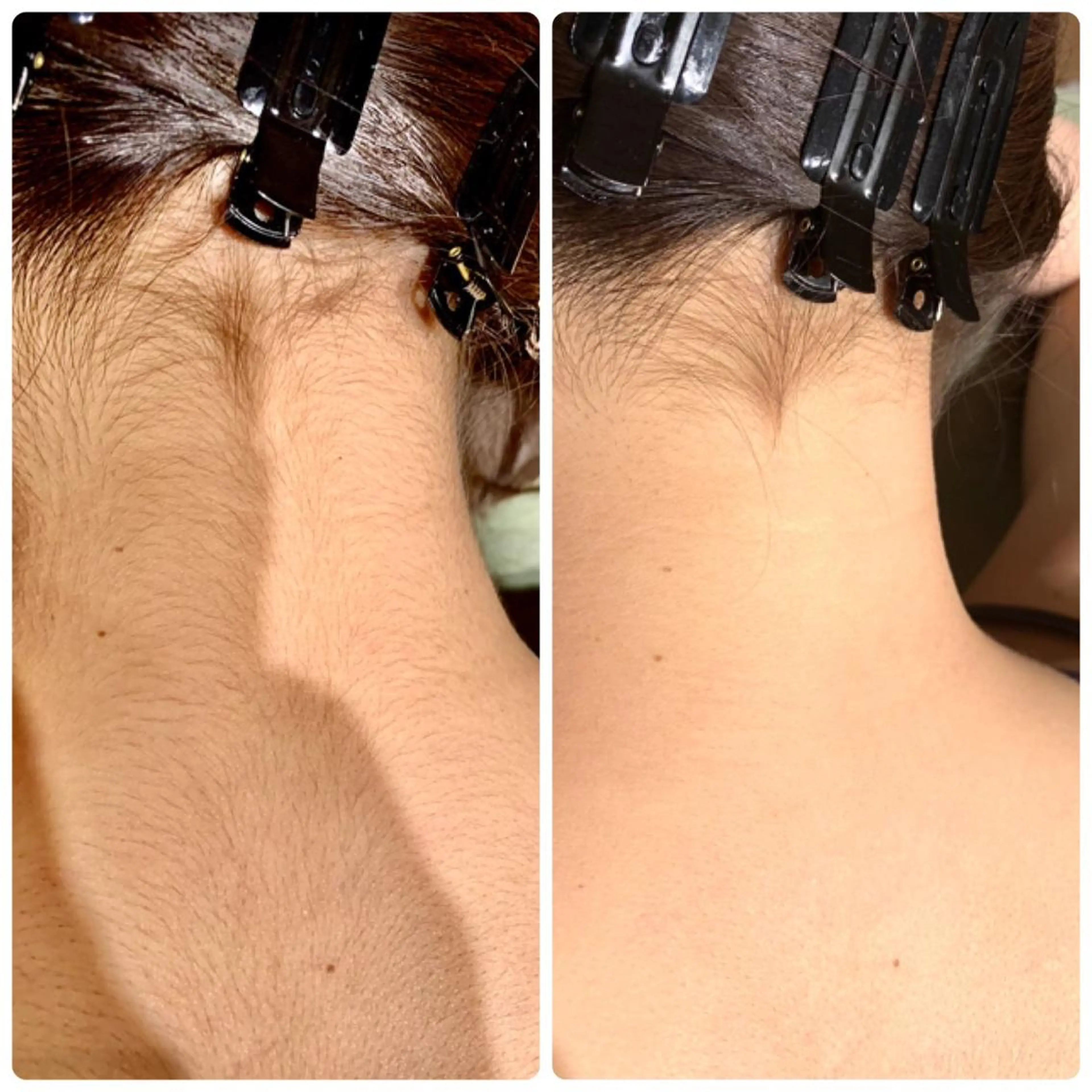 ビューティーサロン リノアのエステ・リラクイメージ