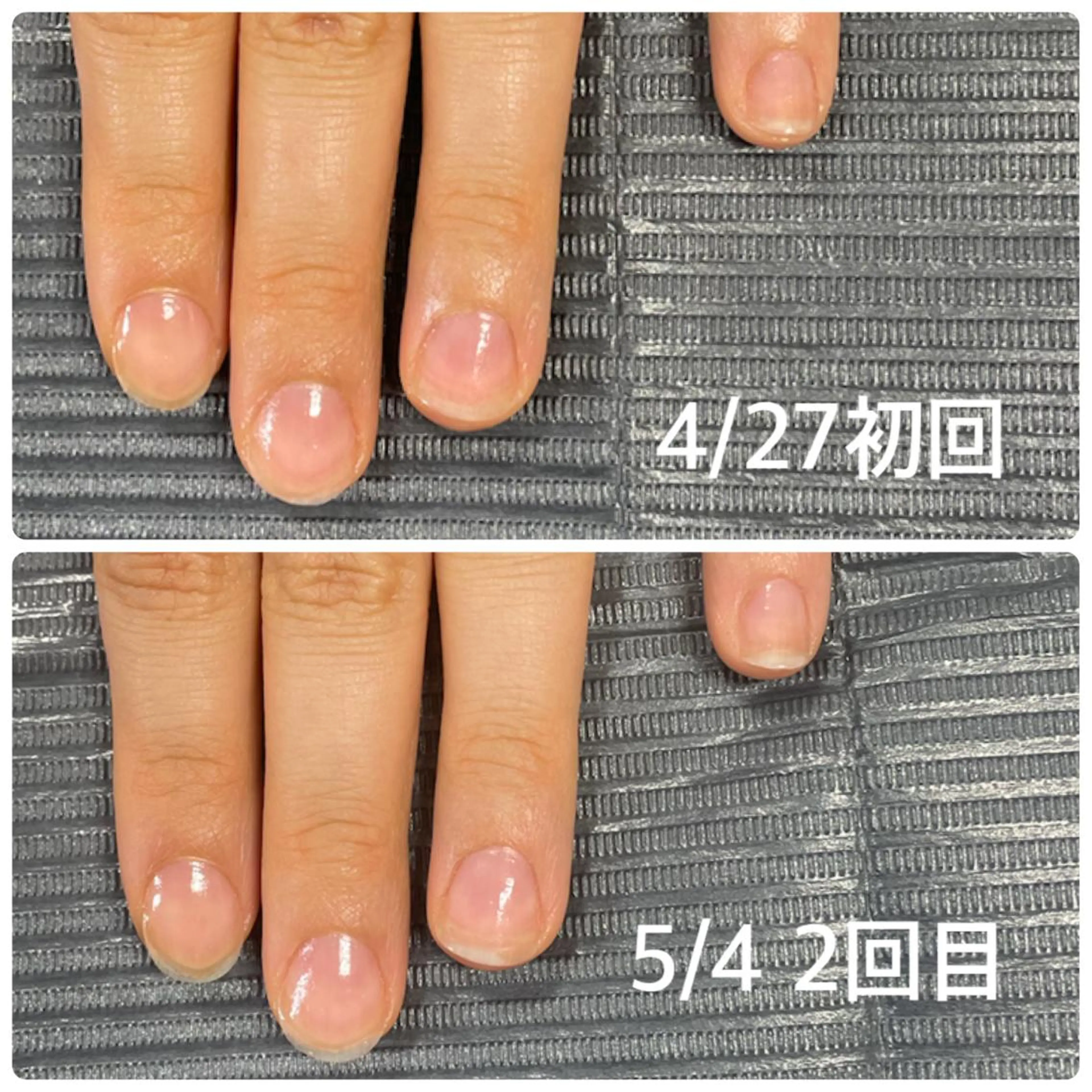 ネイル 奥園 良恵のネイルデザイン