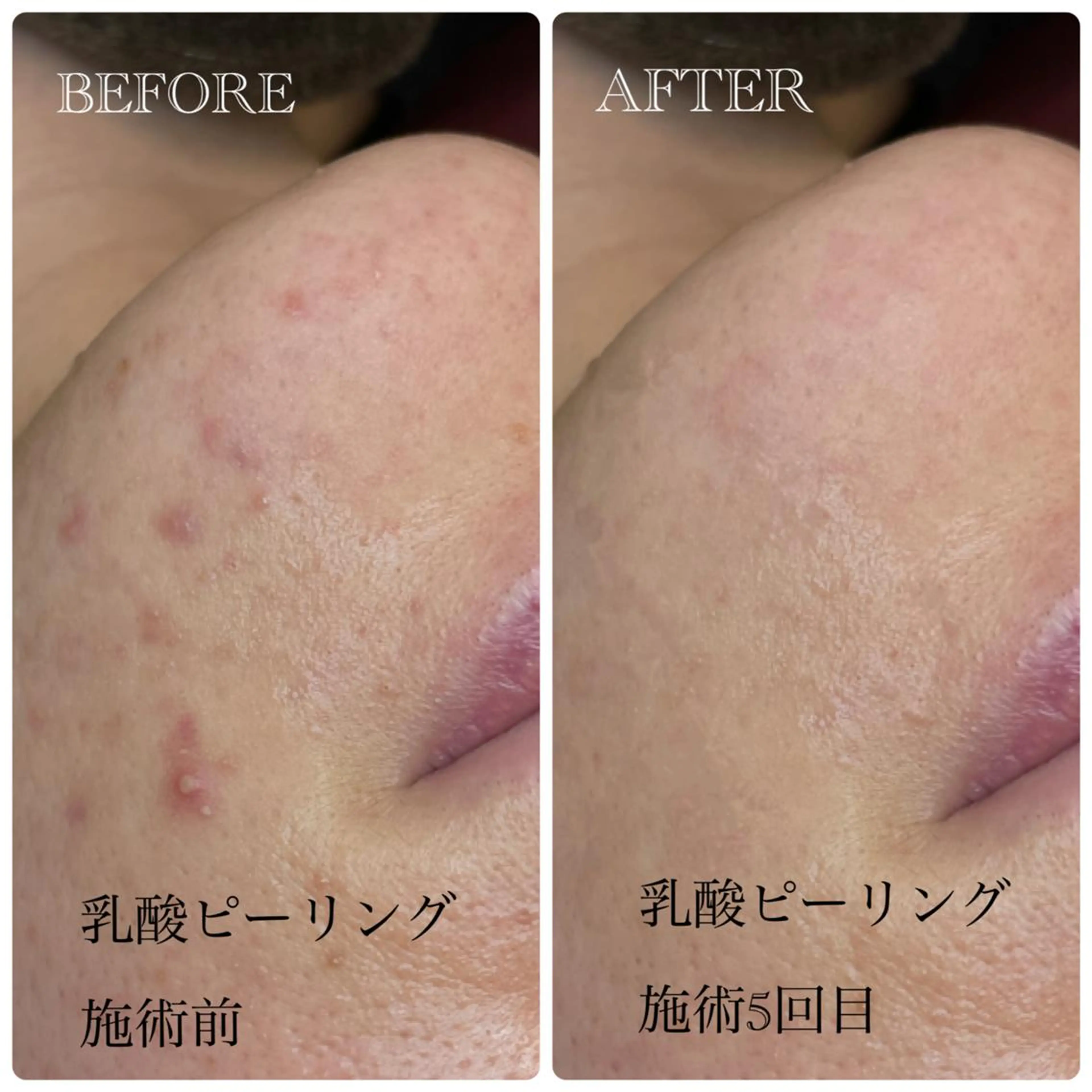 Crescent Beautyのエステ・リラクイメージ