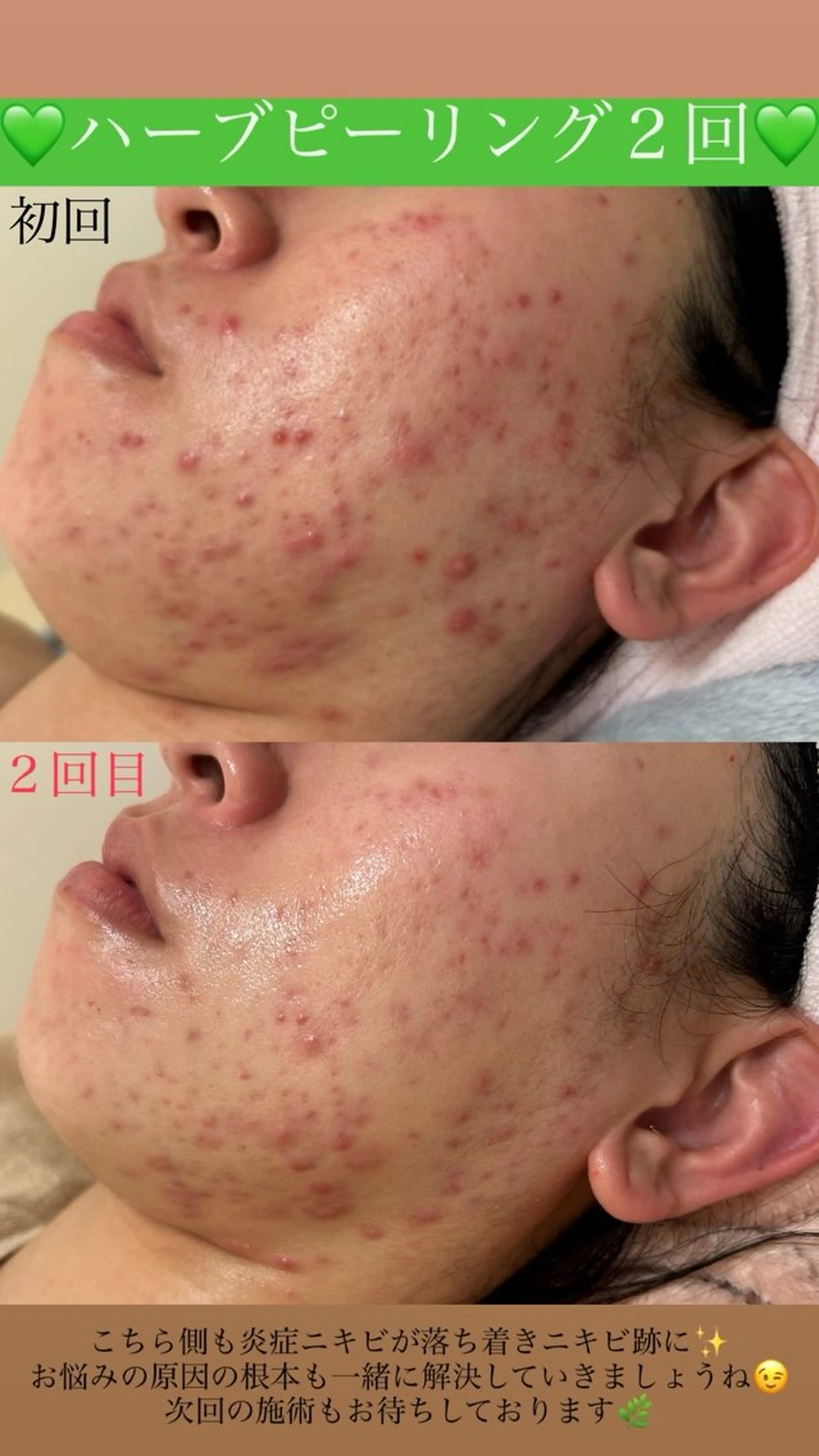 メンズ エステ Salon de Lino 御器所のエステ・リラクイメージ