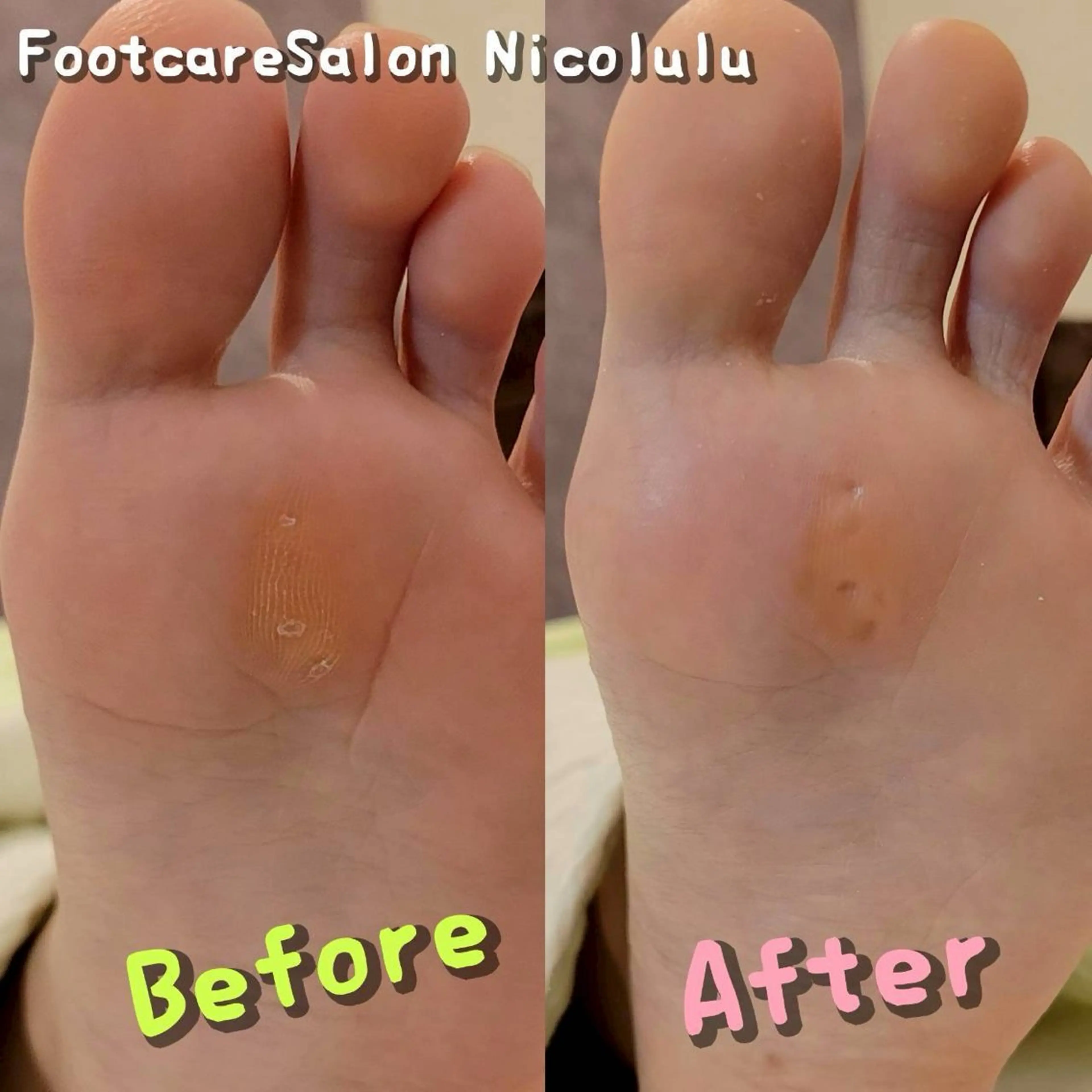 リラク 足トラブル専門 ニコルル金沢のエステ・リラクイメージ