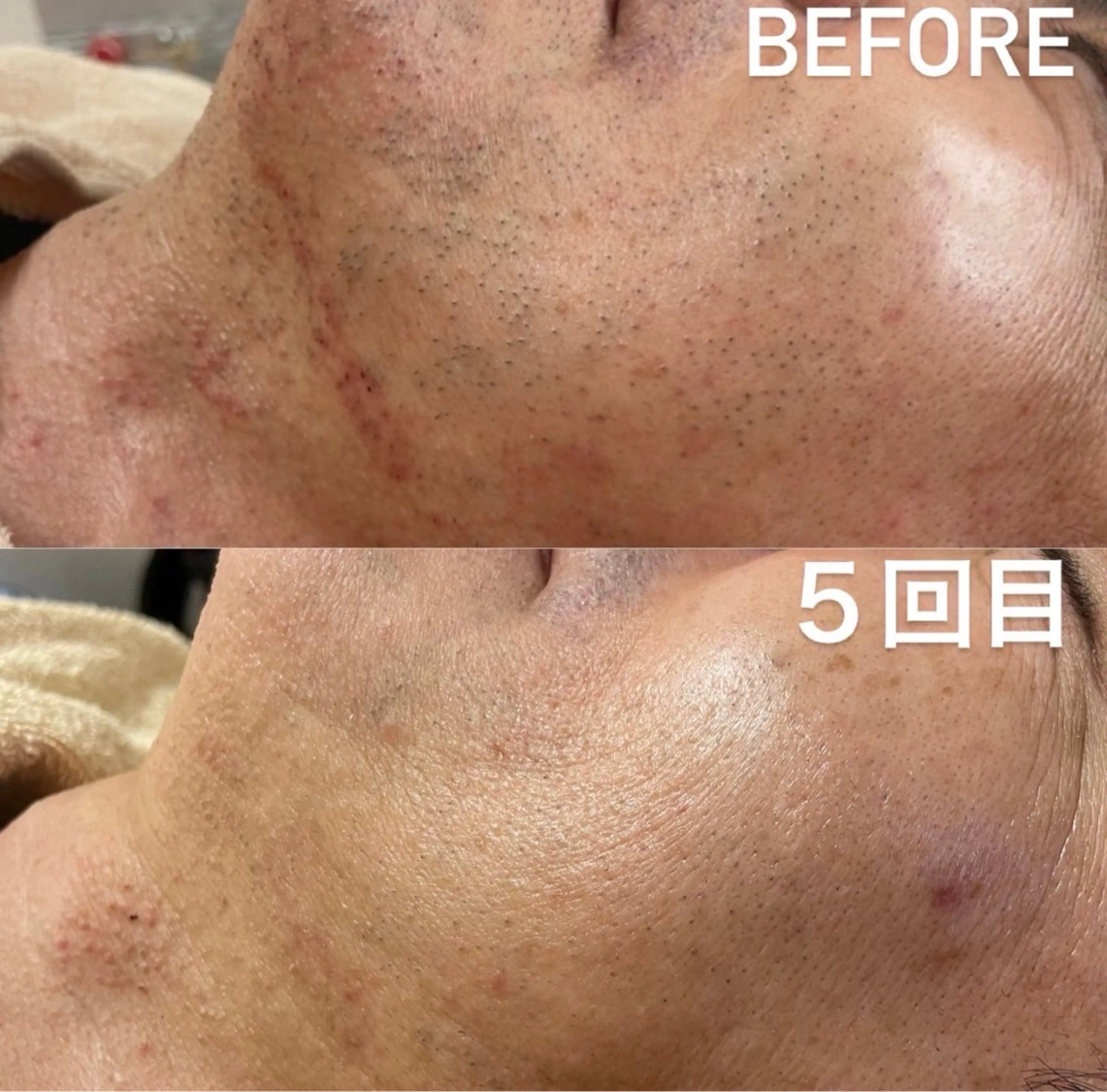 メンズ EARTH coiffure beaute 小山店所属・EARTH 小山店 shimaのエステ・リラクイメージ