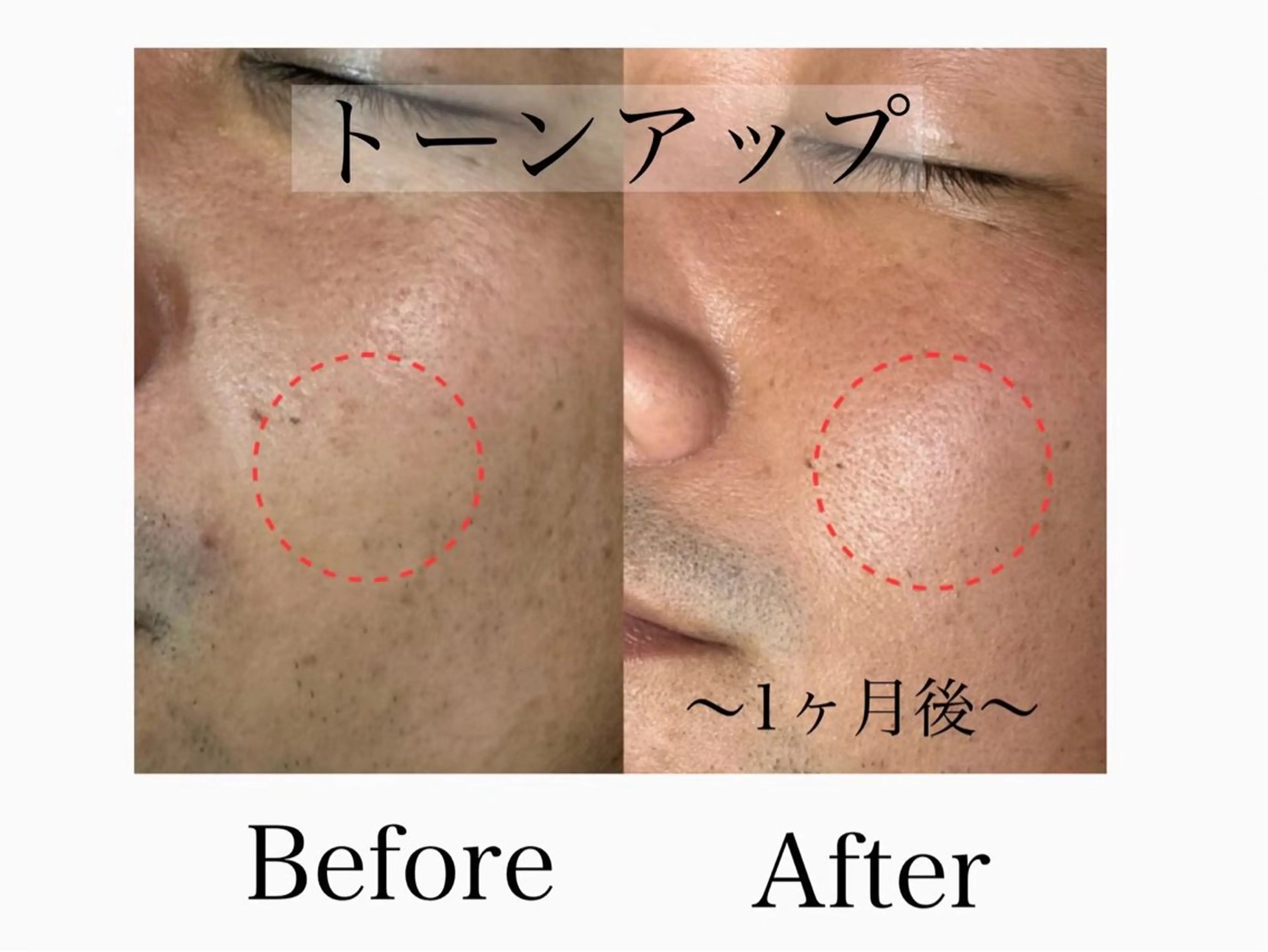 エステ 六本木/似合わせ眉毛 andＳ🍀Yuriのエステ・リラクイメージ