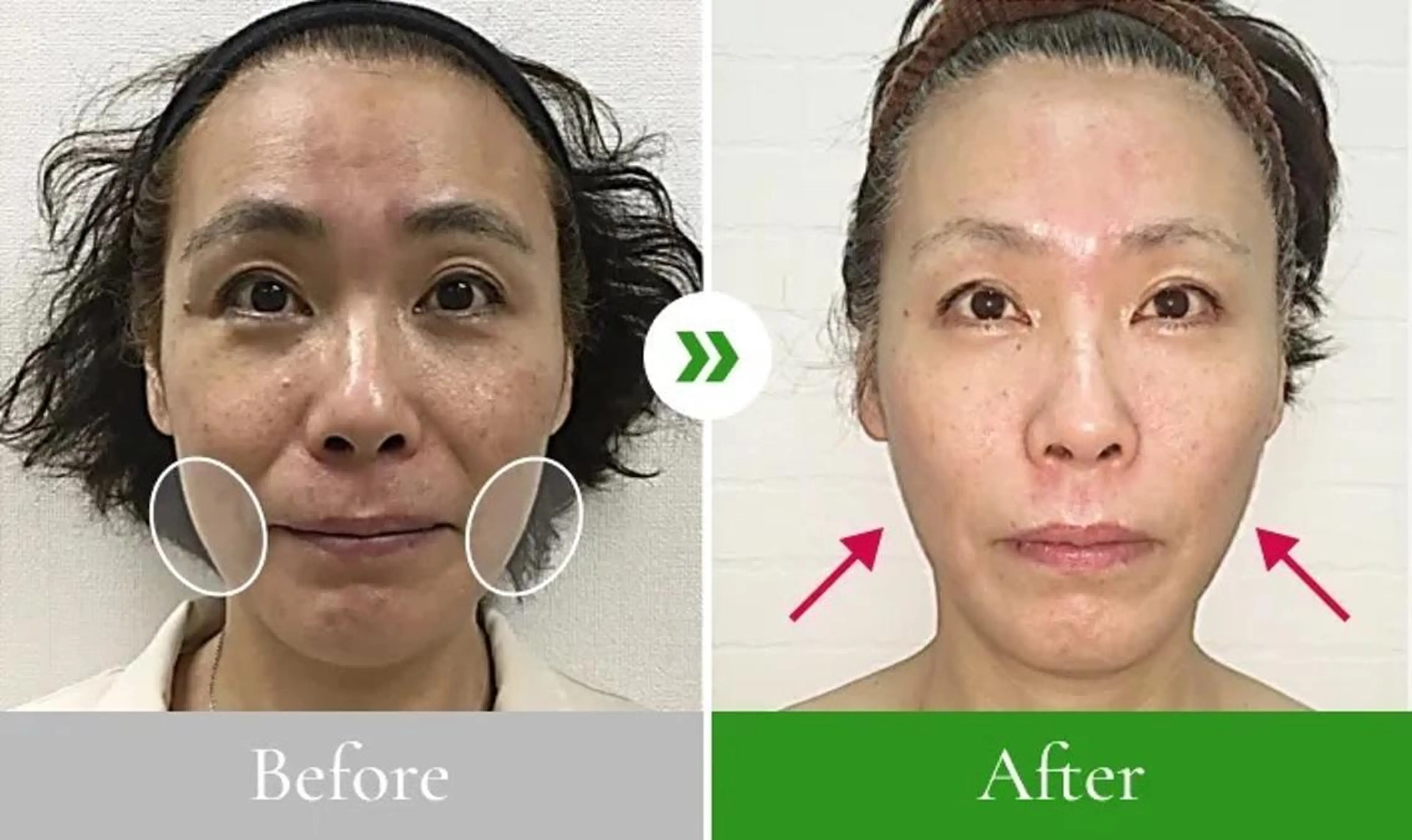 小顔整体研究所 KSラボ川崎店内田のエステ・リラクイメージ