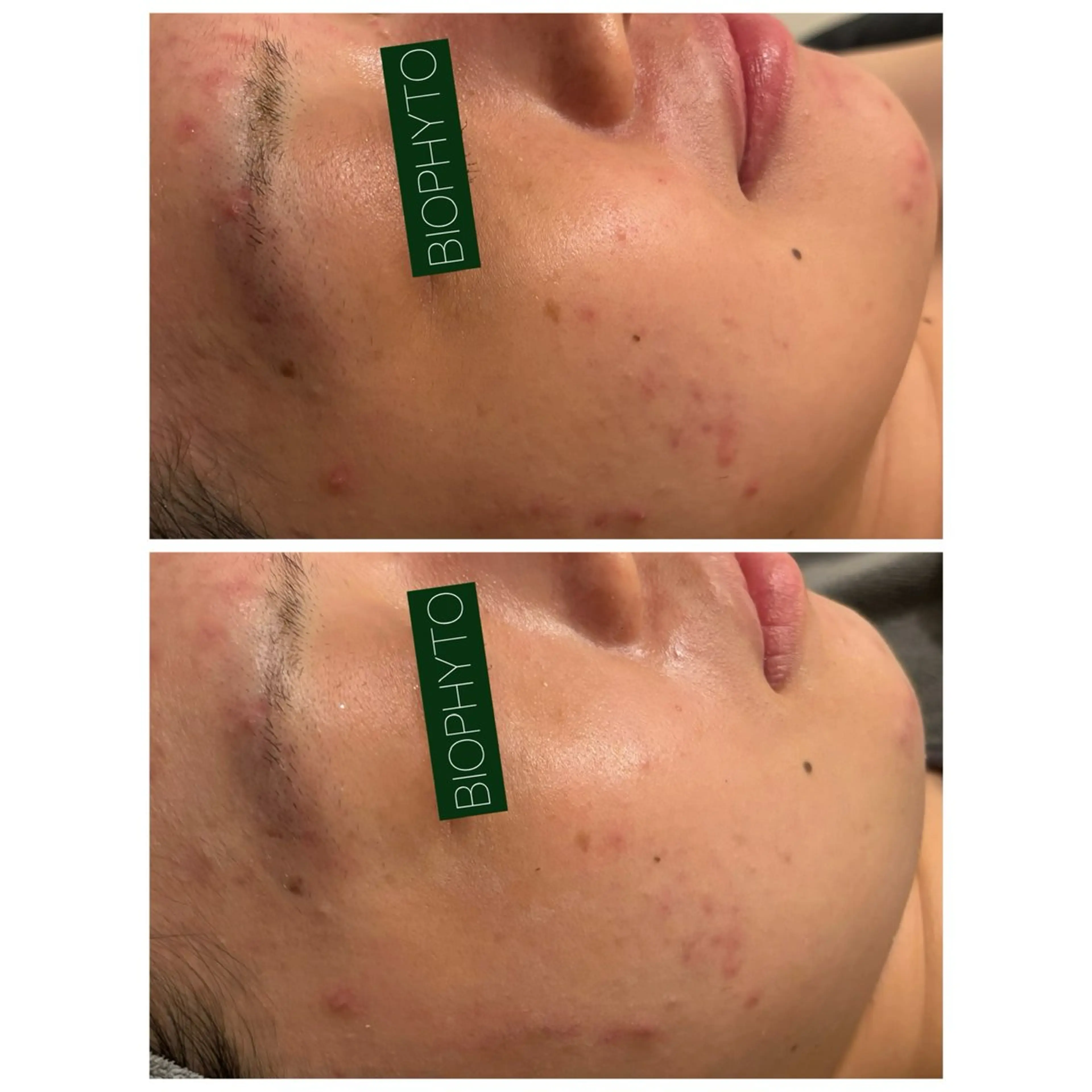 エステ リラク ☆痩身/小顔☆ コルギのエステ・リラクイメージ