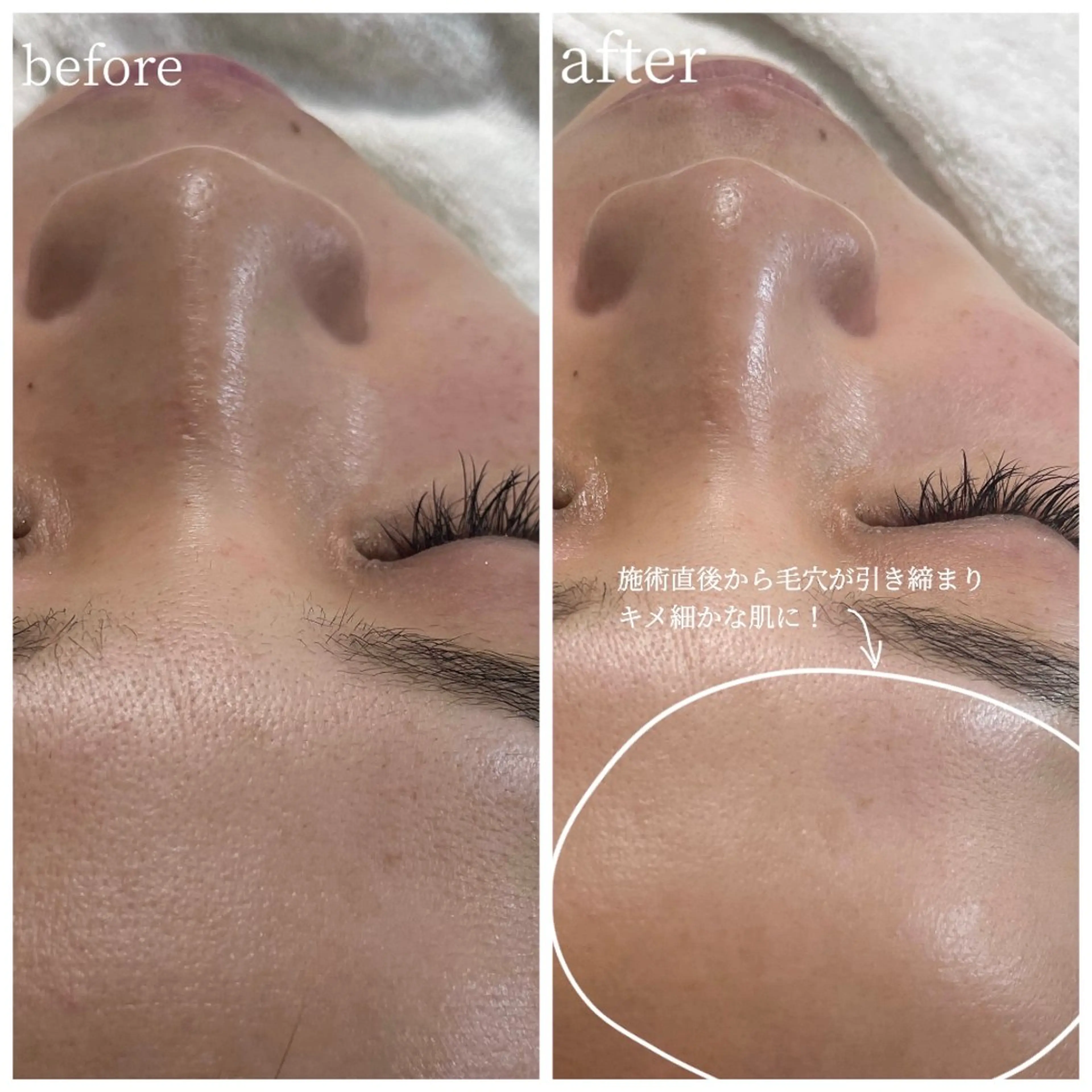 Lereve 三宮店所属・Lereve .三宮店のエステ・リラクイメージ