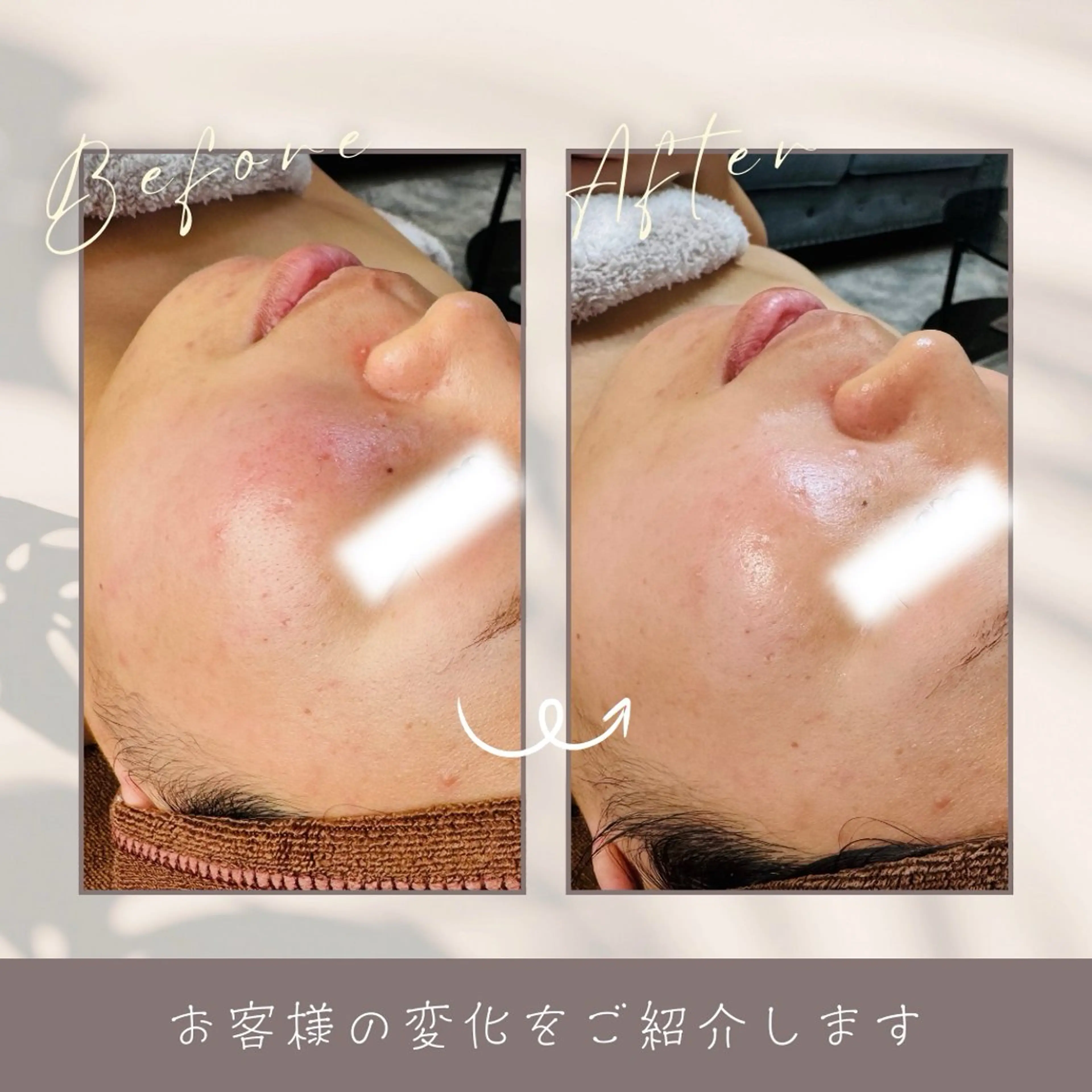 LukeBeauty salonのエステ・リラクイメージ