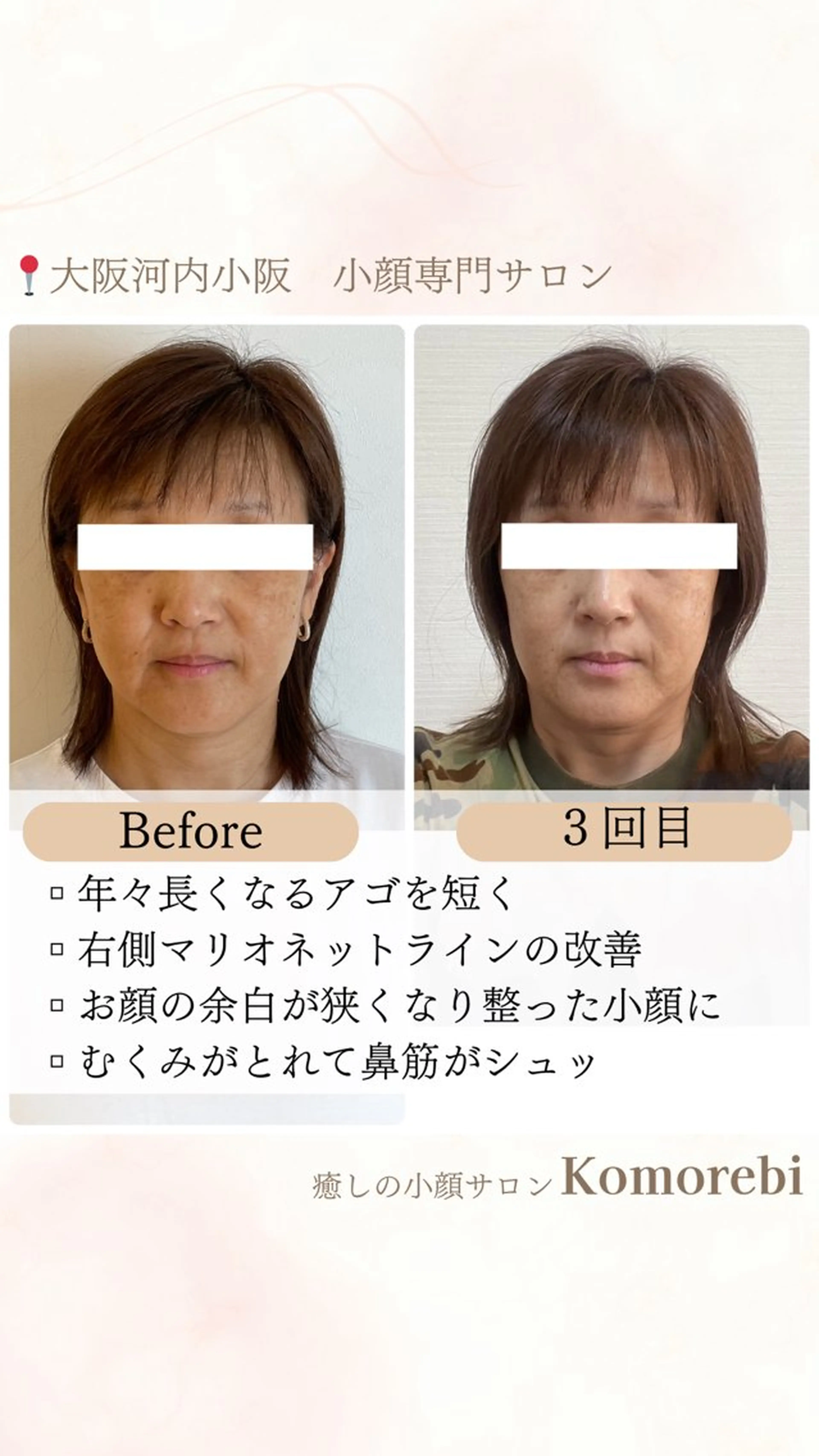 営業電話❌小顔サロン Komorebiのエステ・リラクイメージ