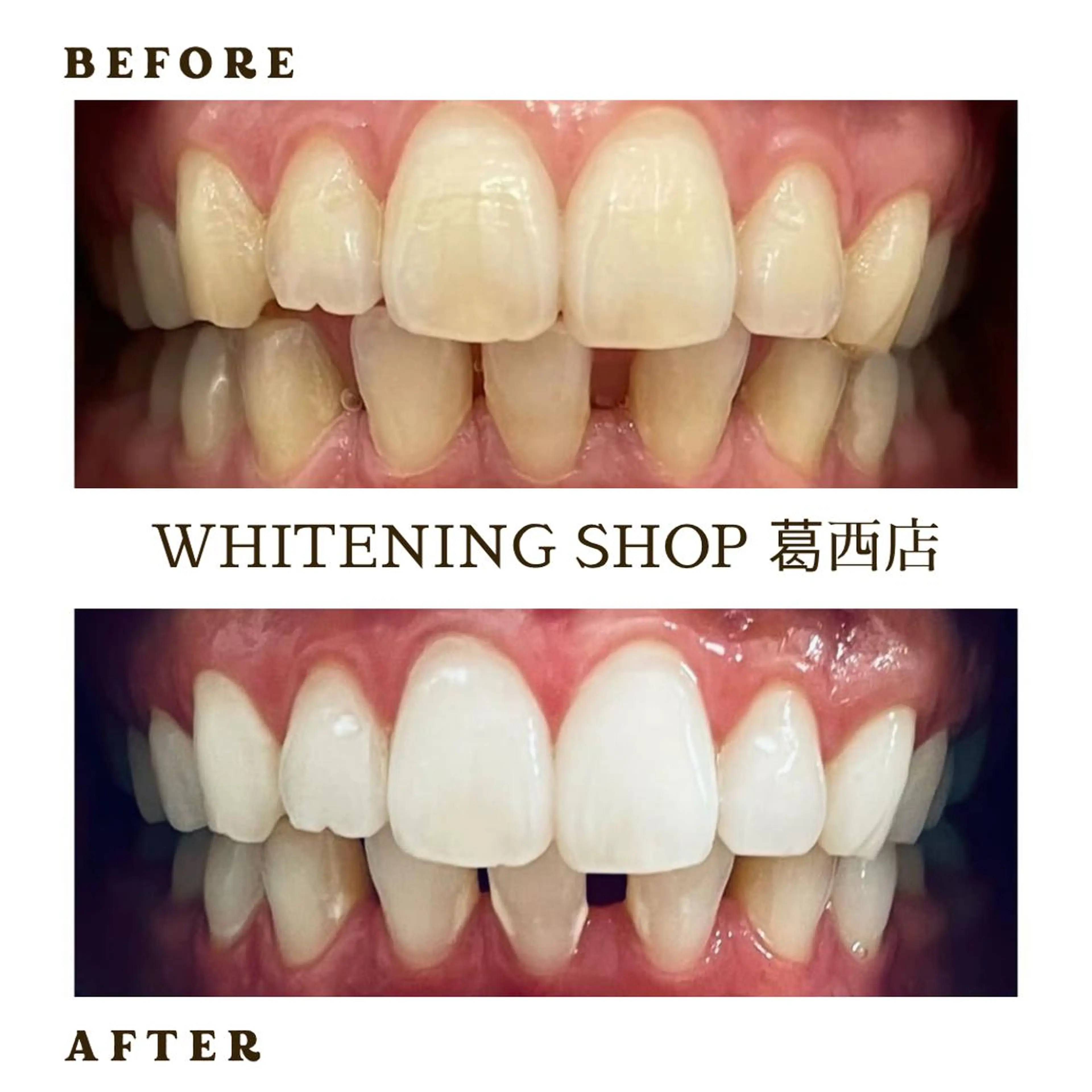 メンズ その他 ホワイトニング ショップ葛西店のその他イメージ