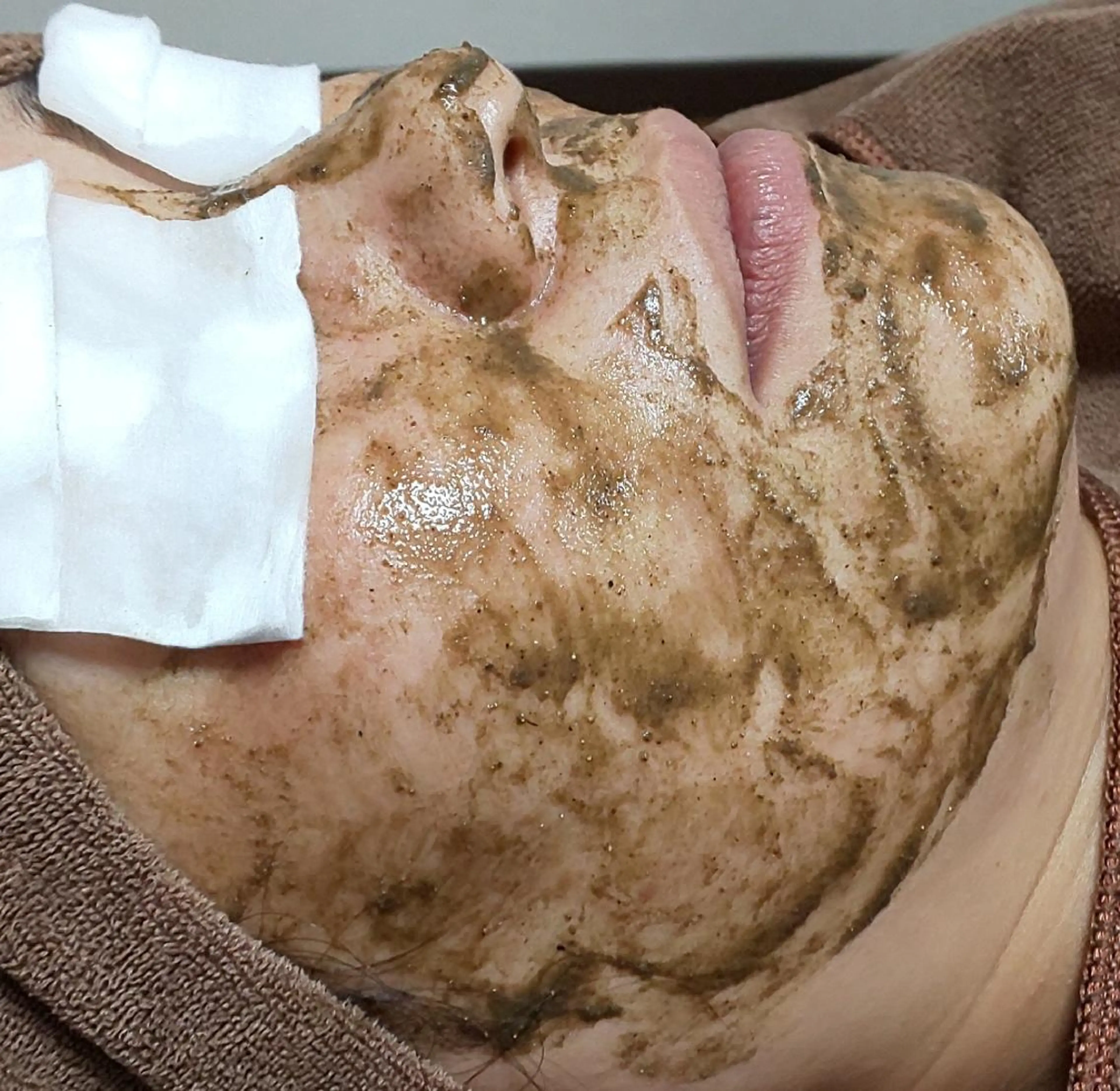 初回お試し ハーブピーリング🌿   お肌ツルツル剥きタマゴ肌✨剥離ありタイプの写真