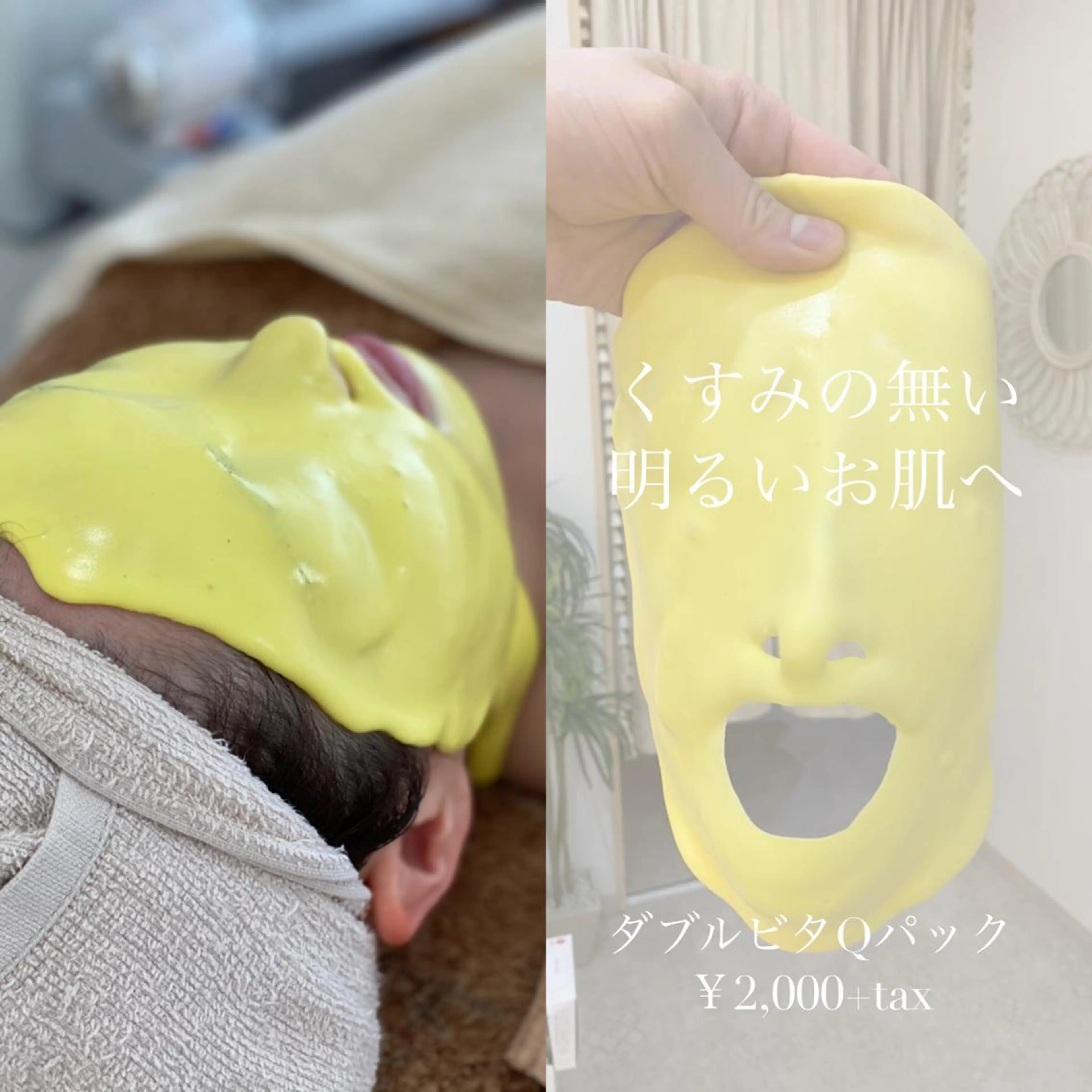 くすみ撃退！ビタミンチャージパック🍋アドバンスコース50分【イルネージュ使用】+ビタミン補給パック(20分)の写真