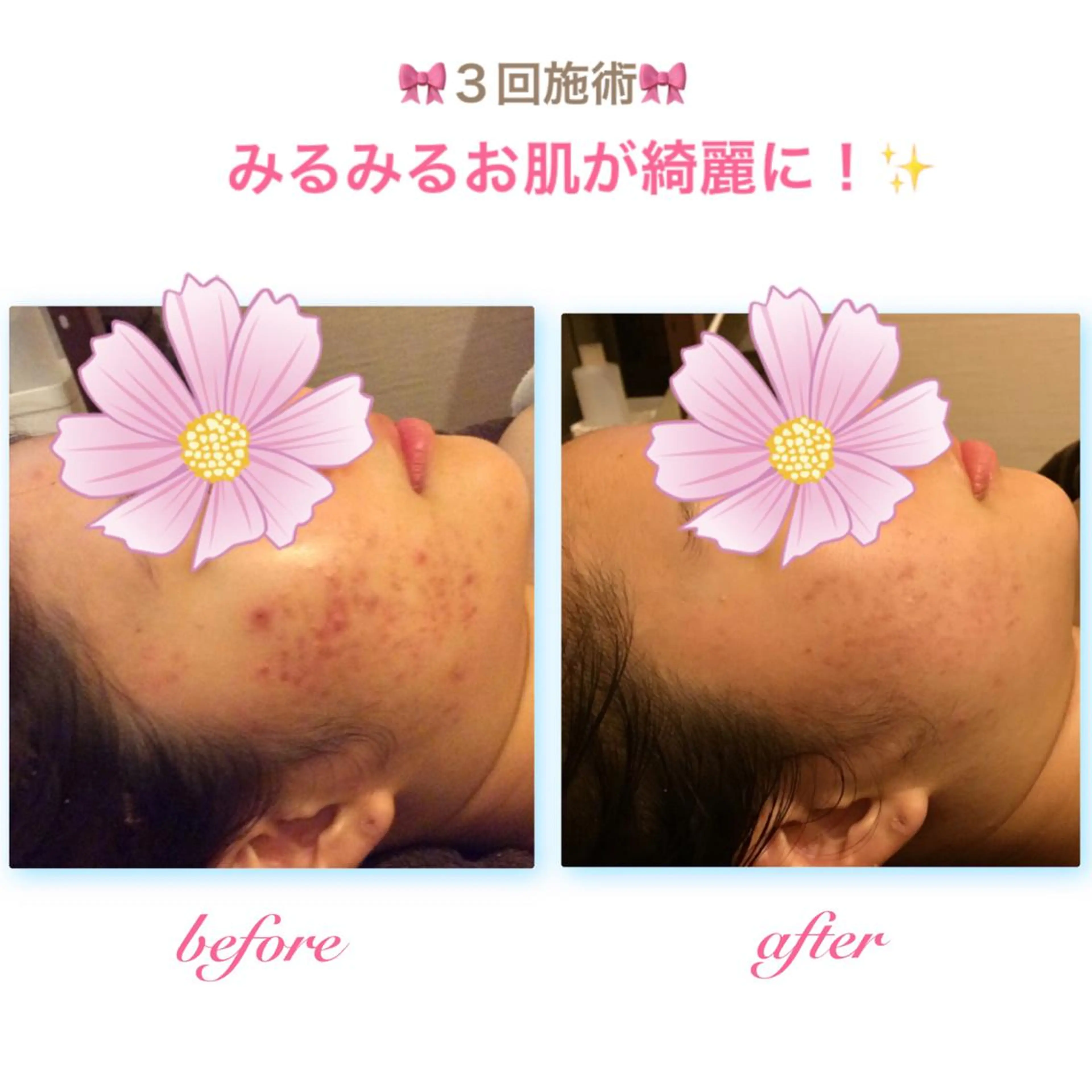 エステ リラク ダイエット・美肌ケア fleurのエステ・リラクイメージ