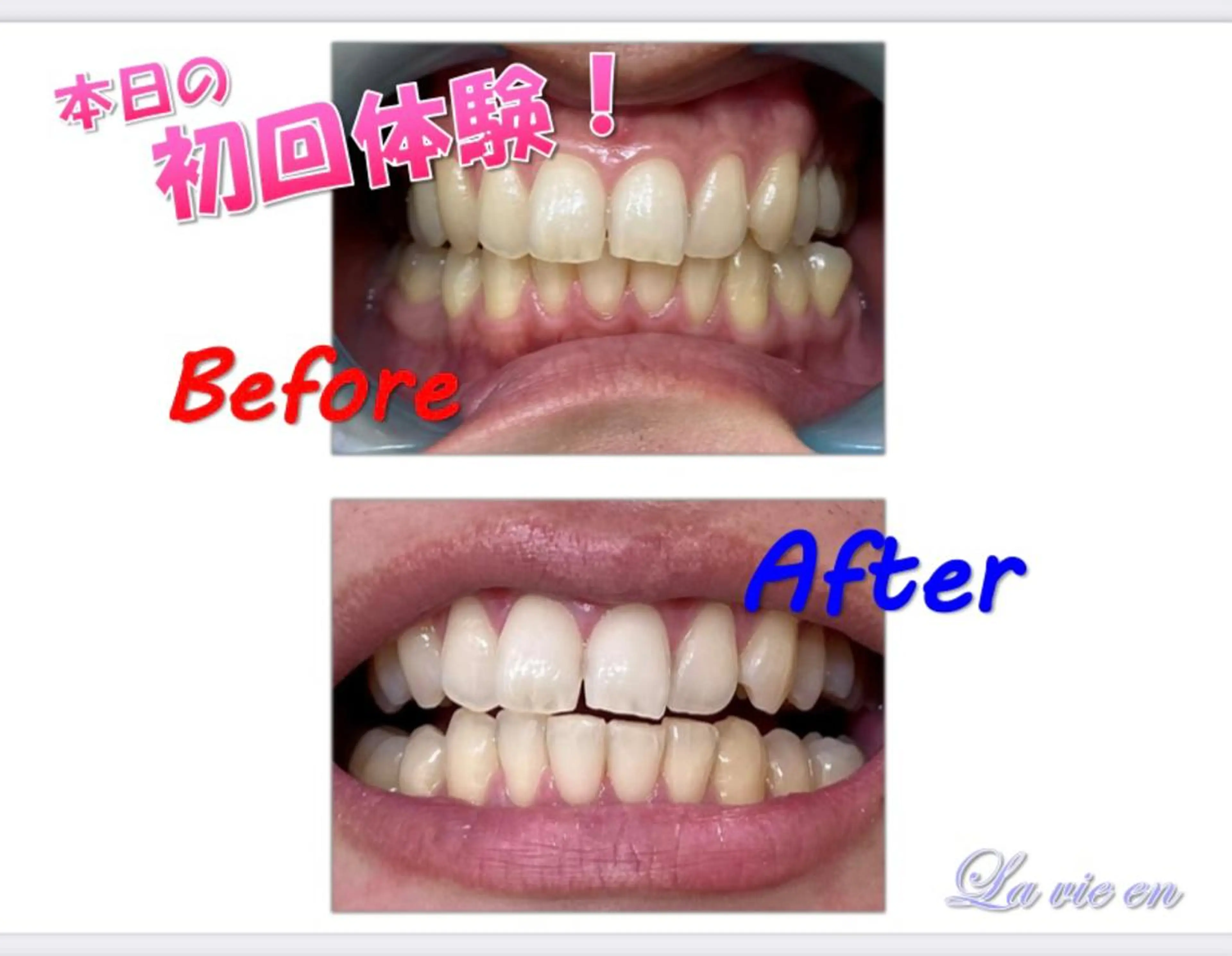 その他 セルフホワイトニングサロン　ラヴィアン所属・ホワイトニングサロン La vie enのその他イメージ