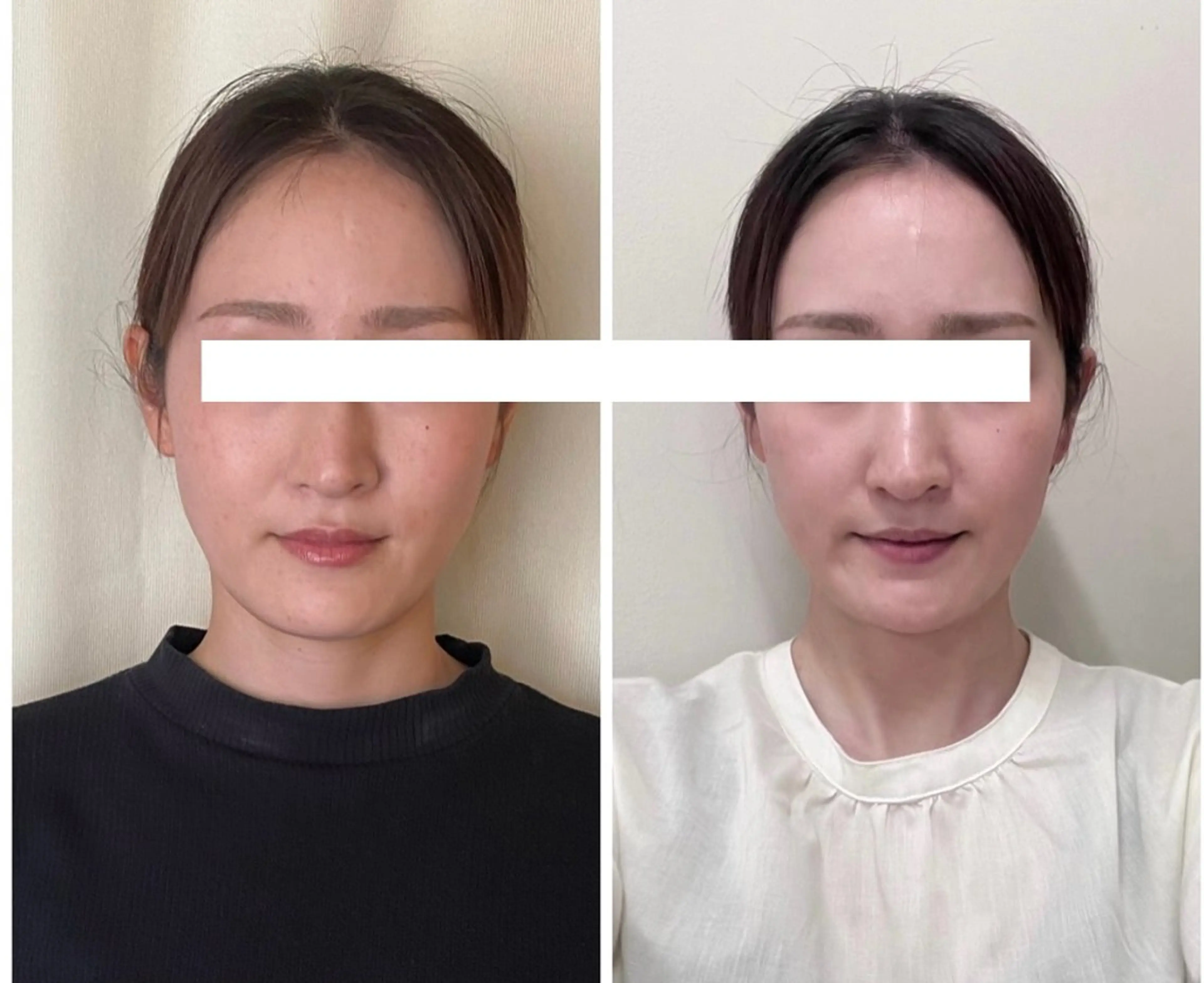 丸顔さんの救世主 高田 くみのエステ・リラクイメージ