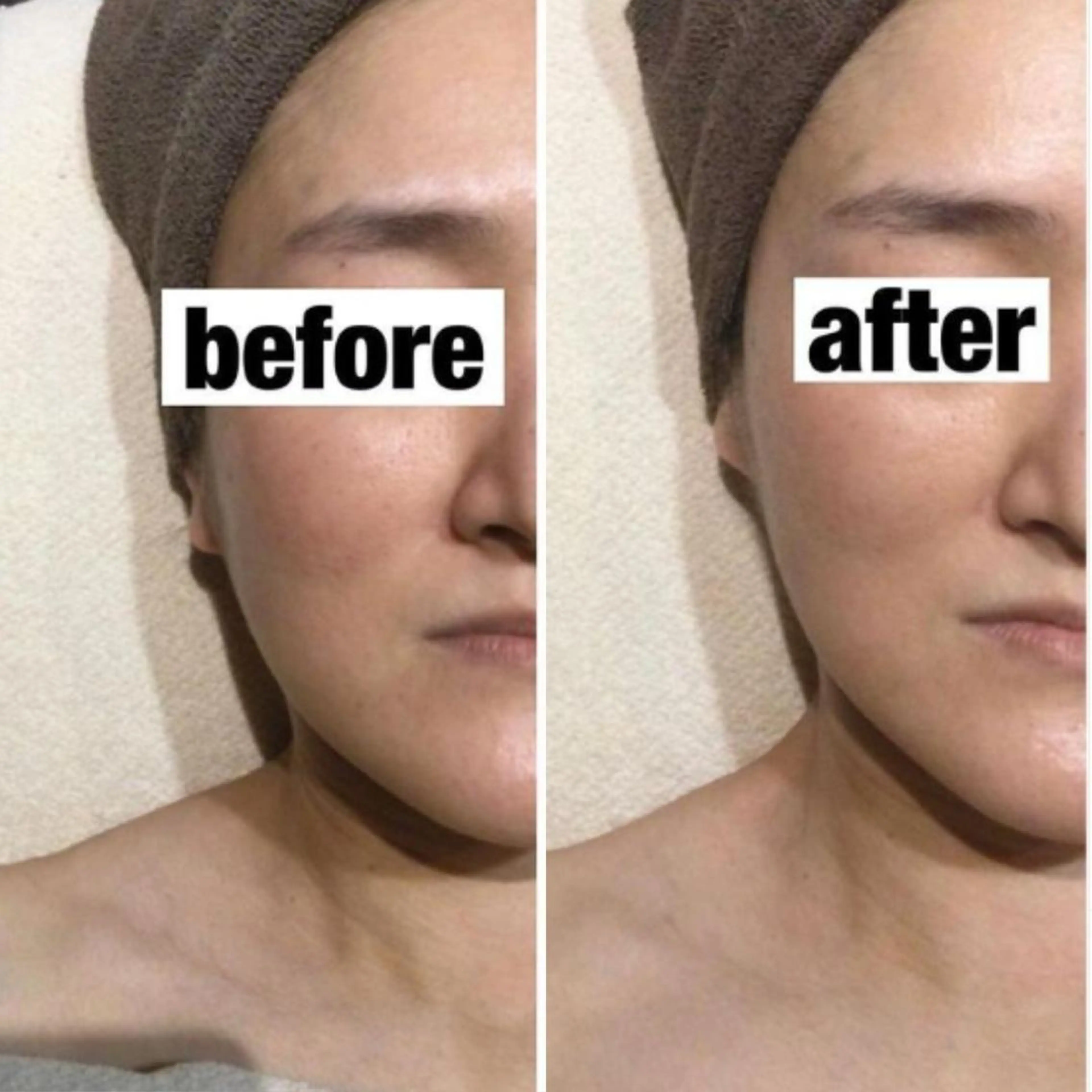 【人気No,1】速攻実感☆小顔ケア+くすみケア60分:21560円→7700円の写真