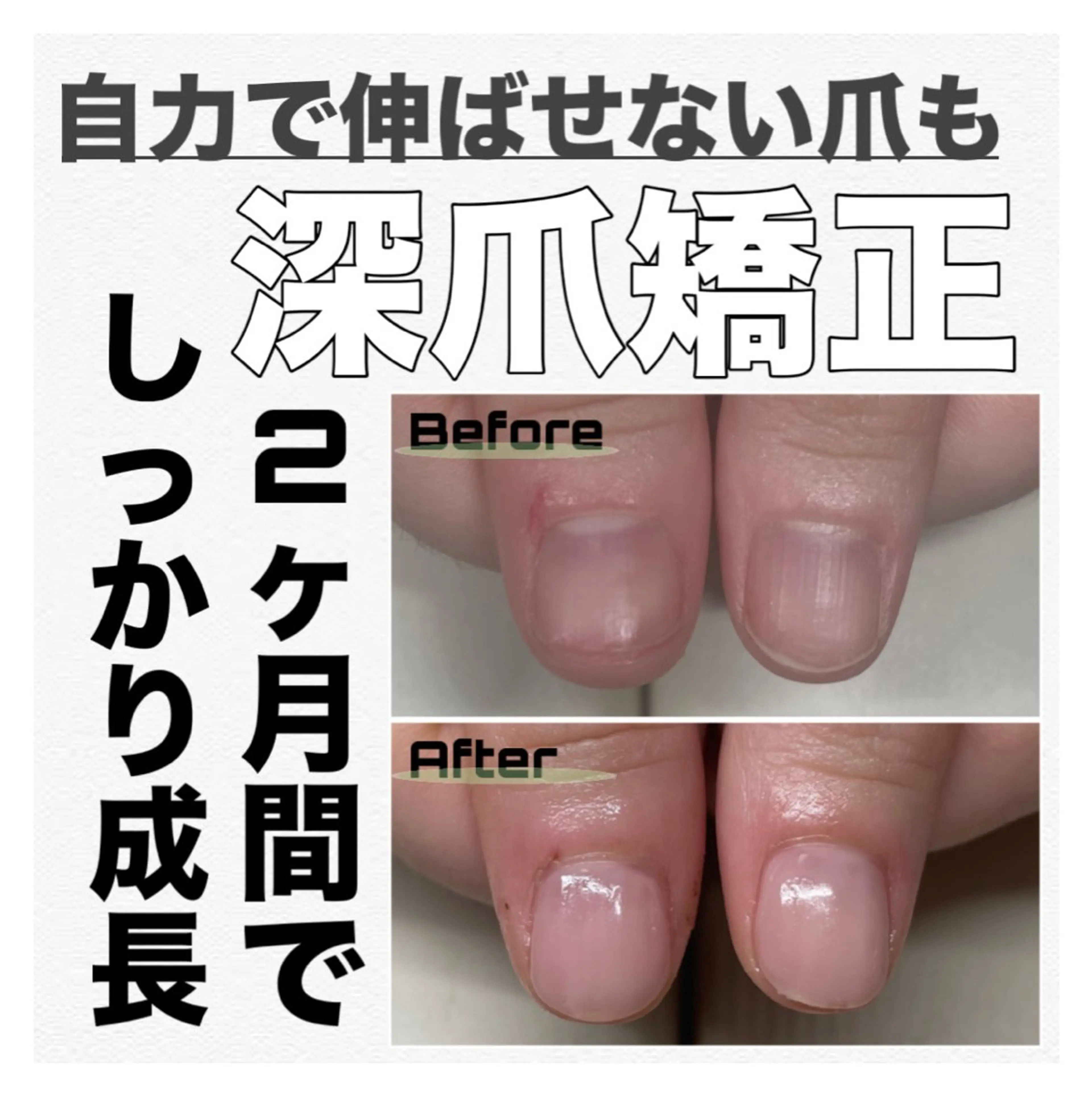 ネイル 長さ出し ジェルネイル petillant所属・nail salon petillantのネイルデザイン