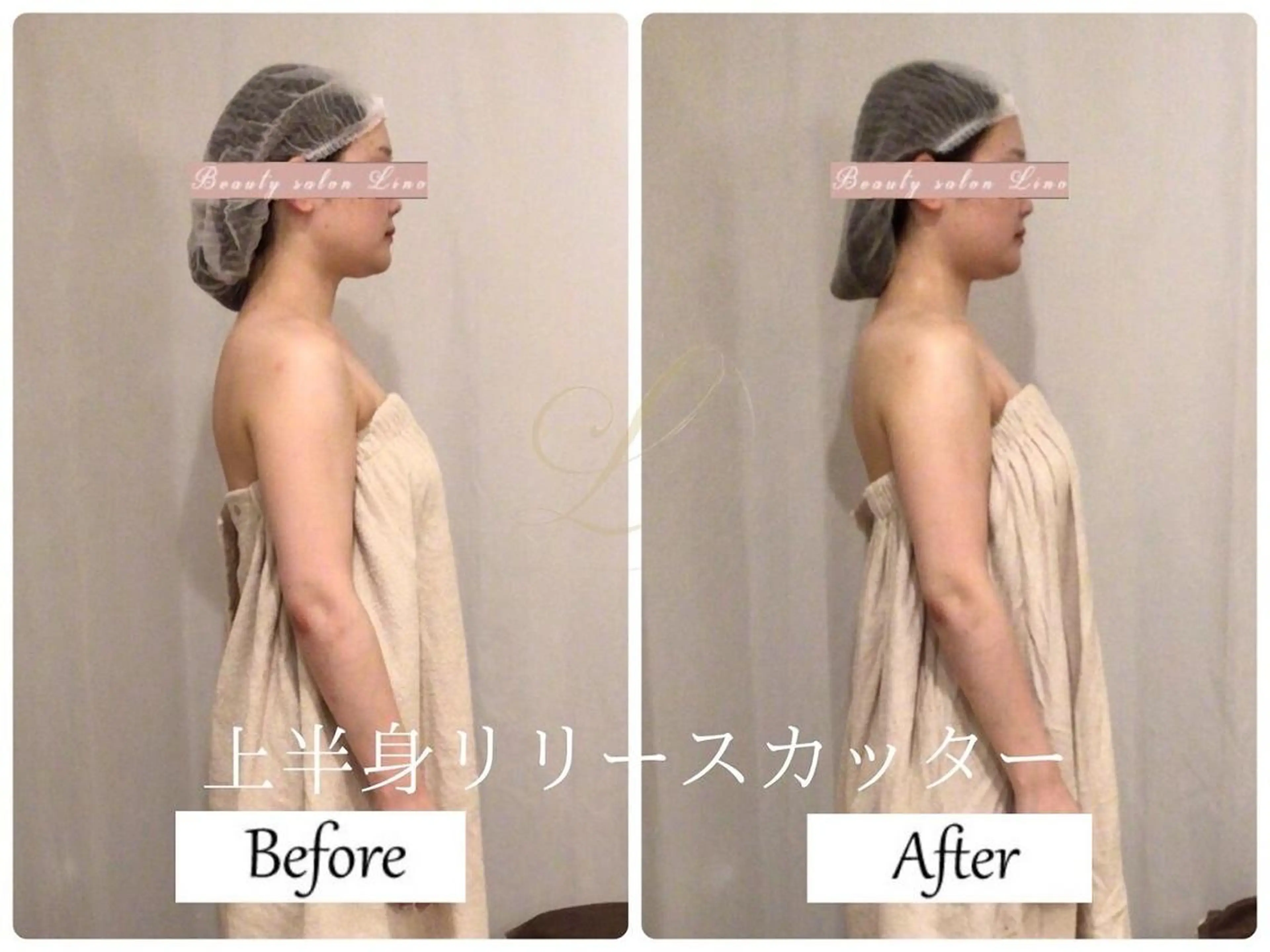 ブライダルサロン ｜Lino【堀江】のエステ・リラクイメージ