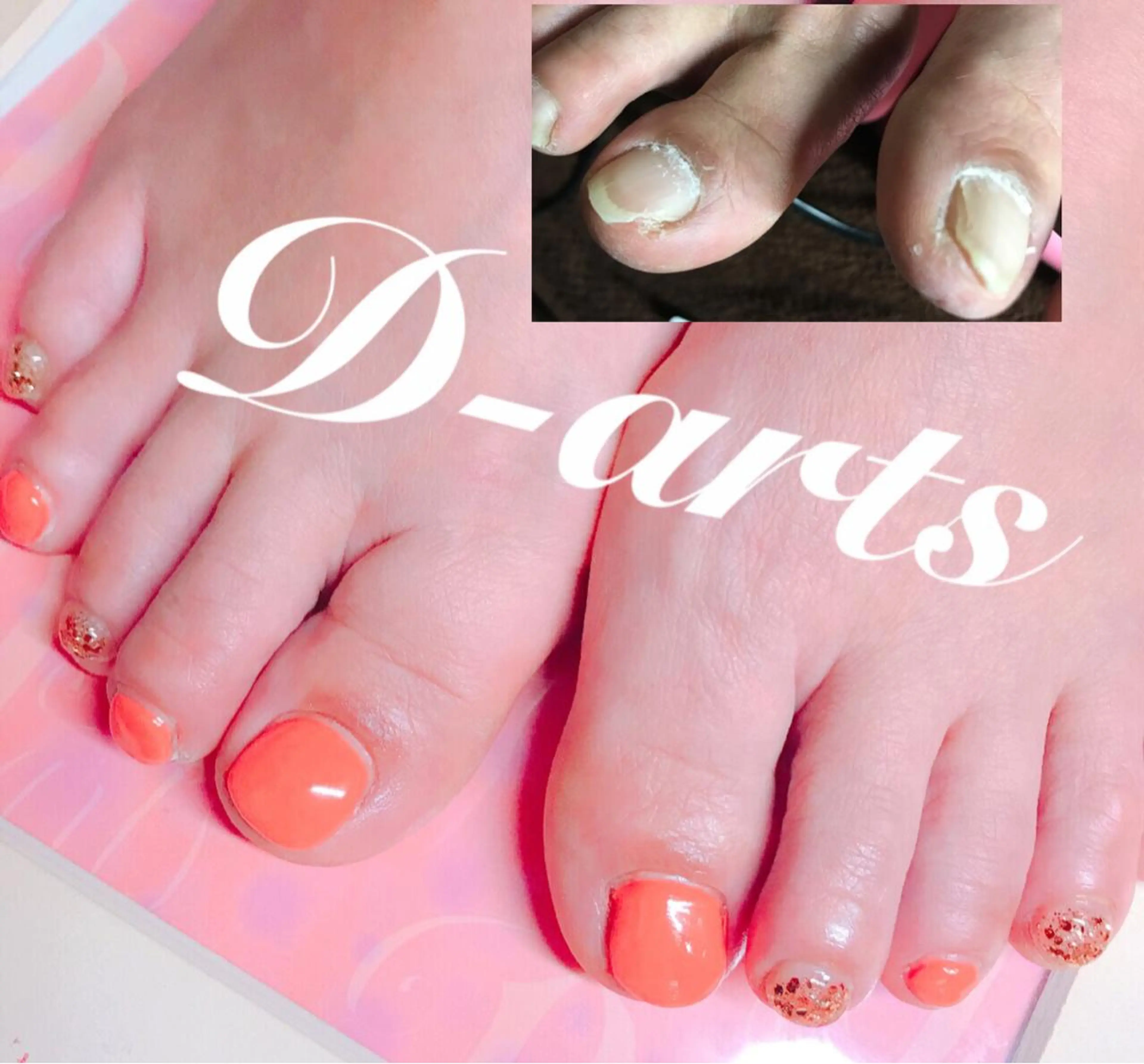 ネイル 長さ出し メンズネイル 持ち込み スカルプネイル ネイルチップ S&S 村田小百合のネイルデザイン