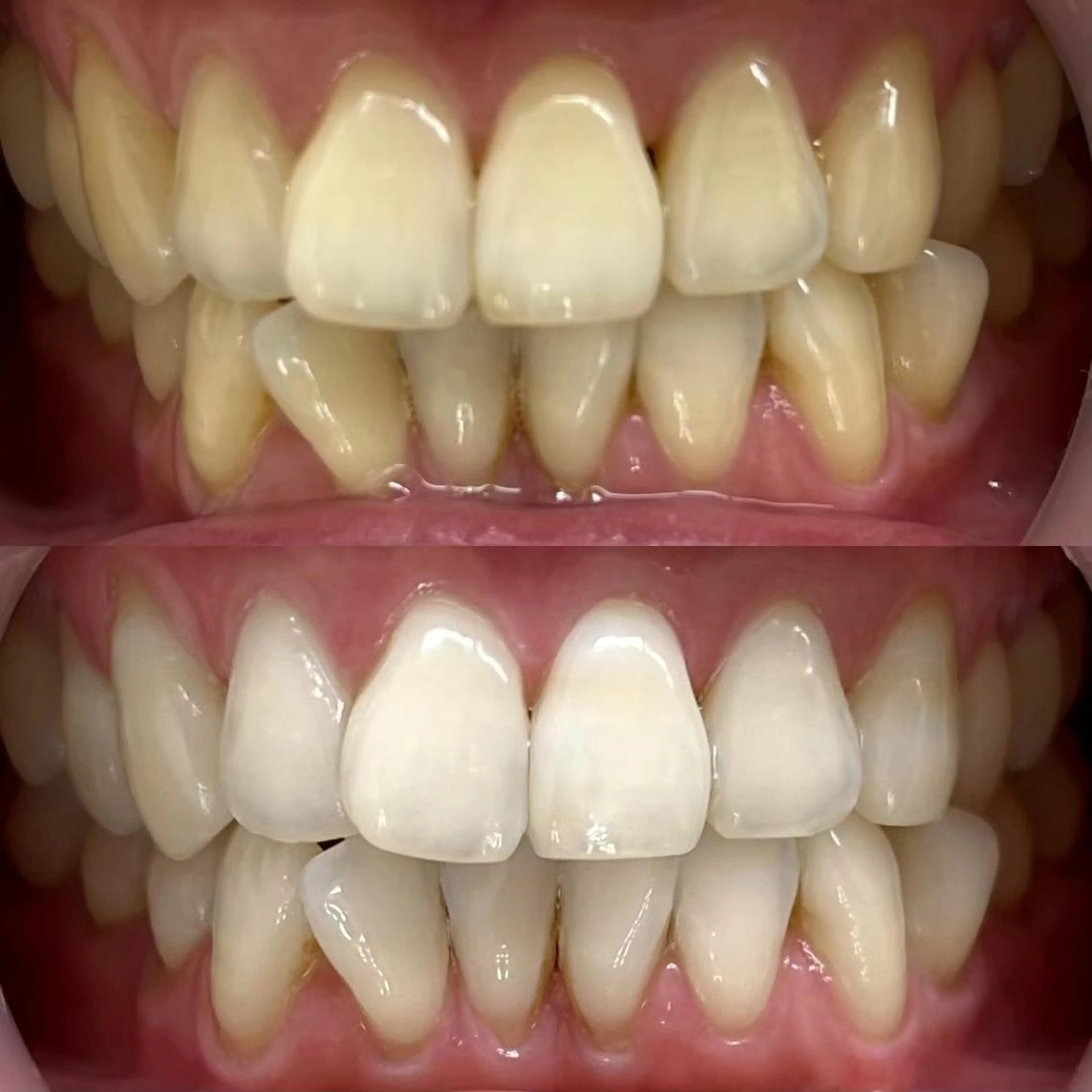 LBSホワイトニング 銀座店💎公式のその他イメージ