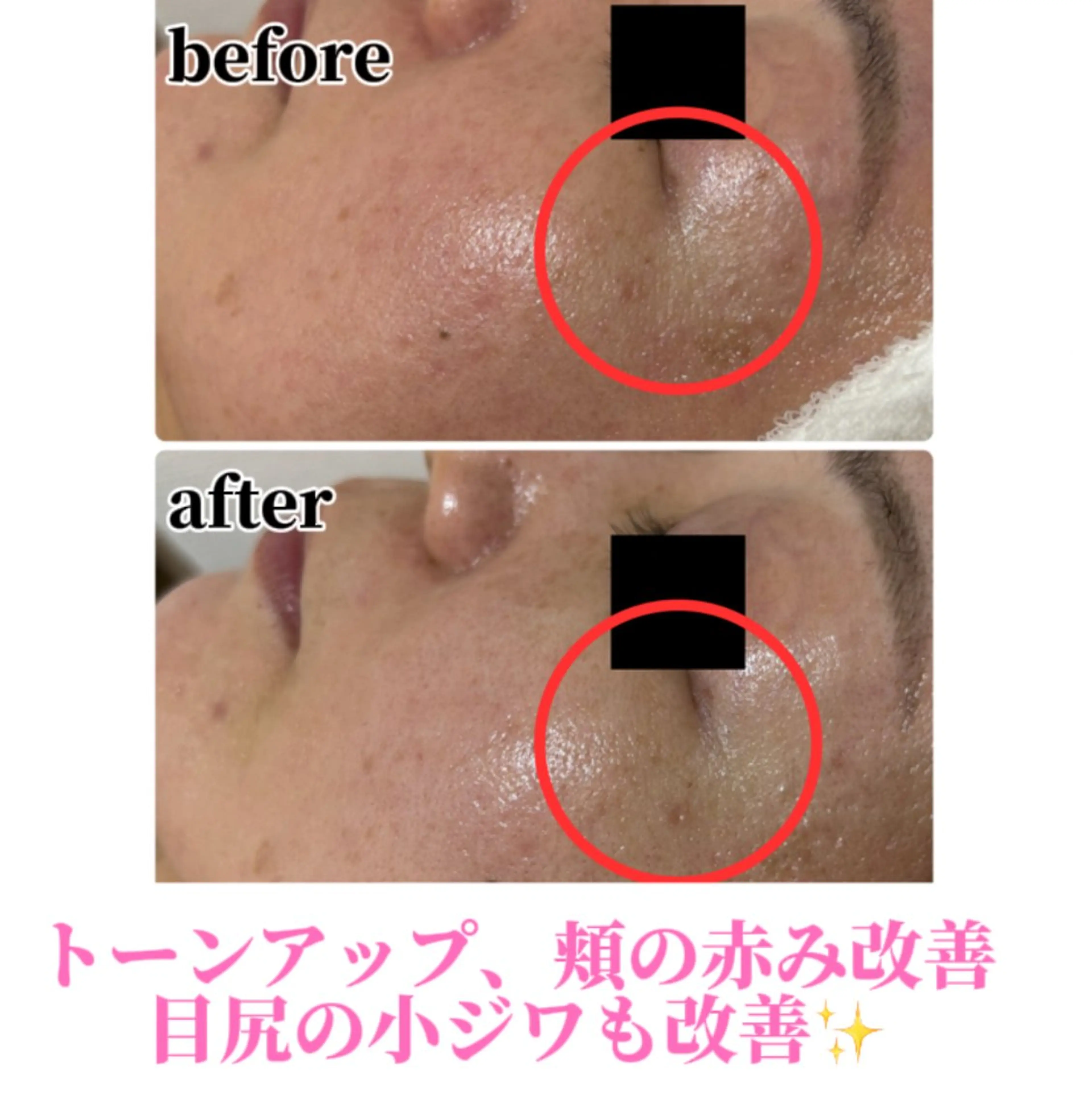 エステ Beauty salonBellのエステ・リラクイメージ