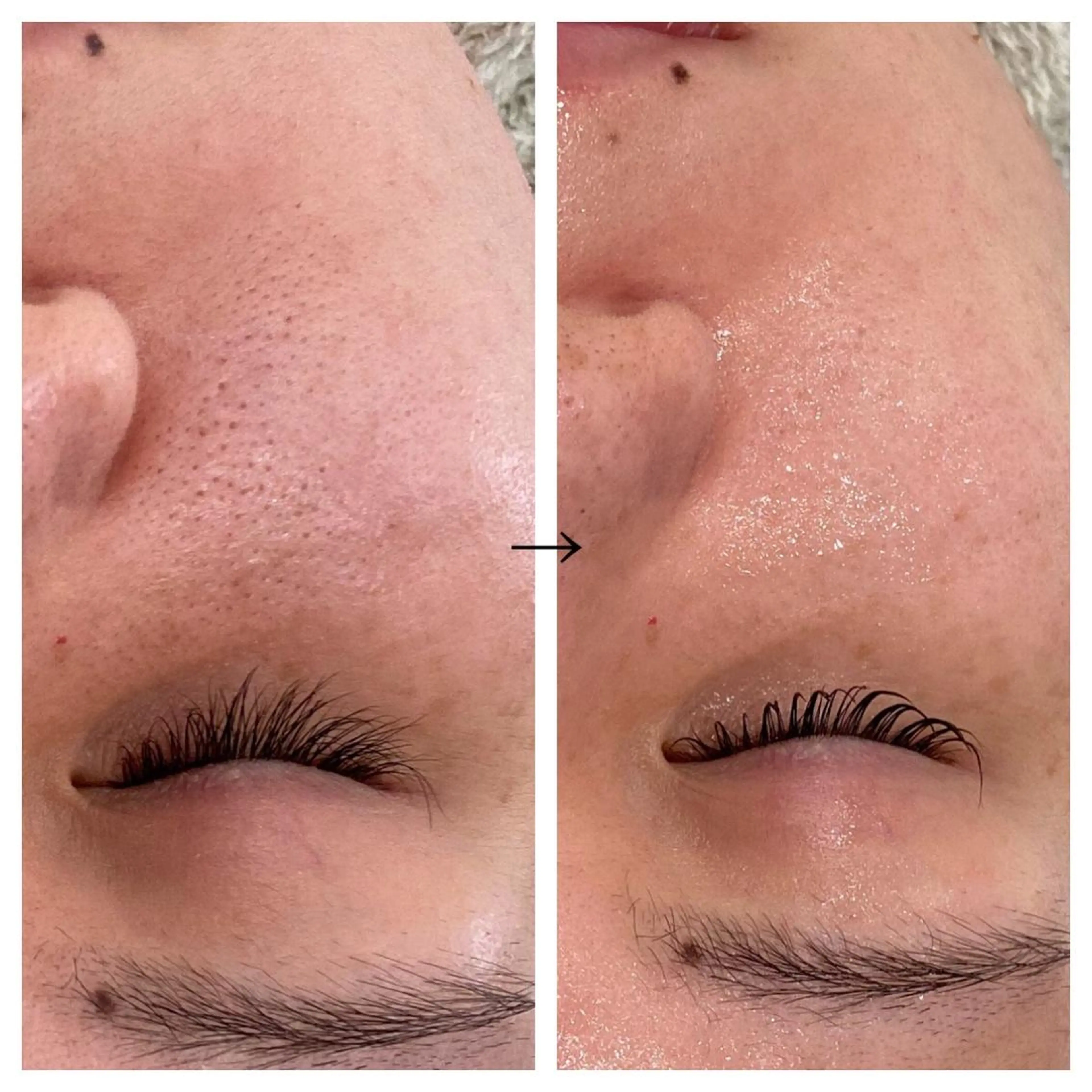 ビューティー ミロワールのエステ・リラクイメージ