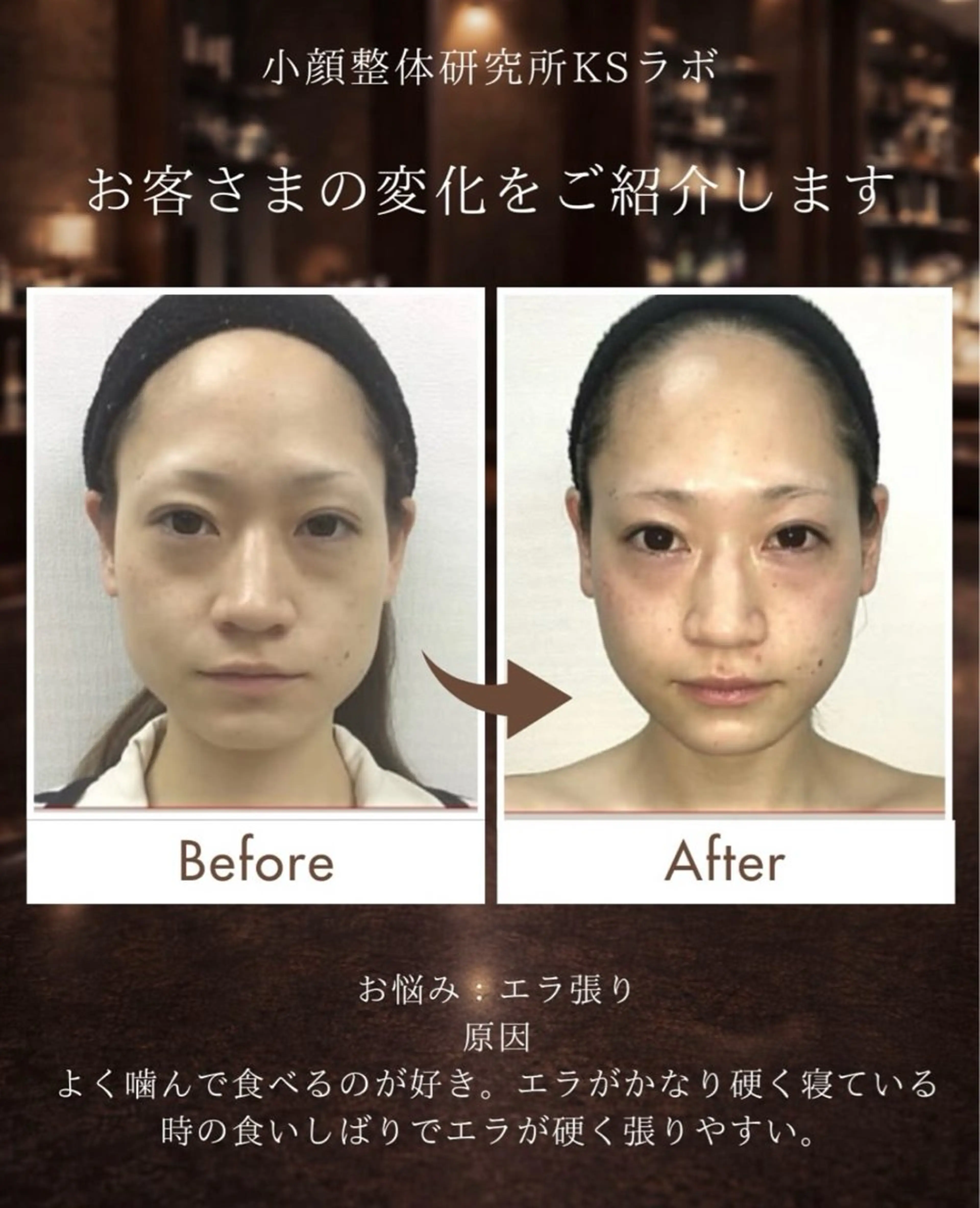 KSラボ自由が丘店所属・小顔整体研究所 KSラボ自由が丘店のエステ・リラクイメージ