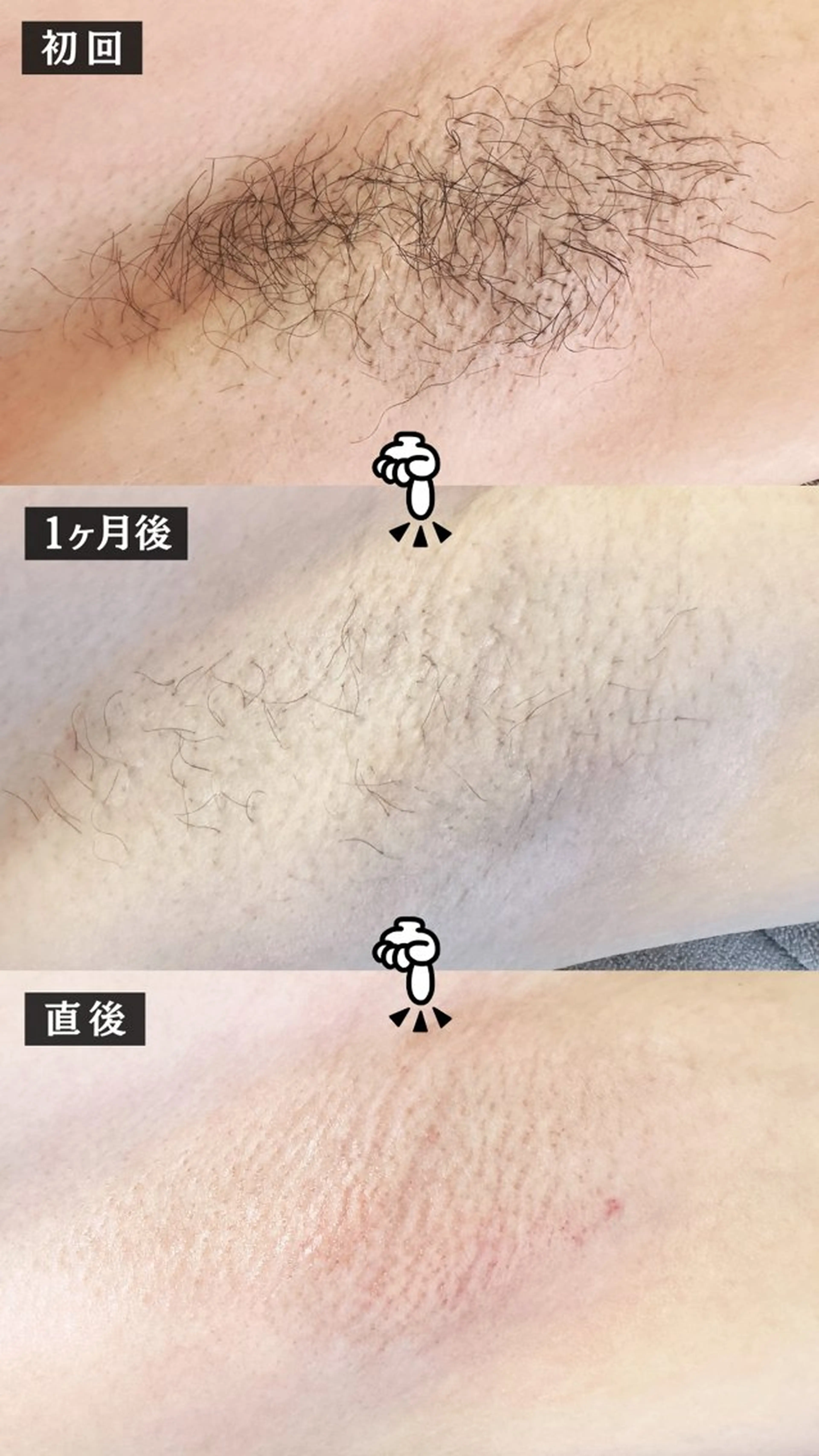 Hit. シュガーリング豊橋のエステ・リラクイメージ