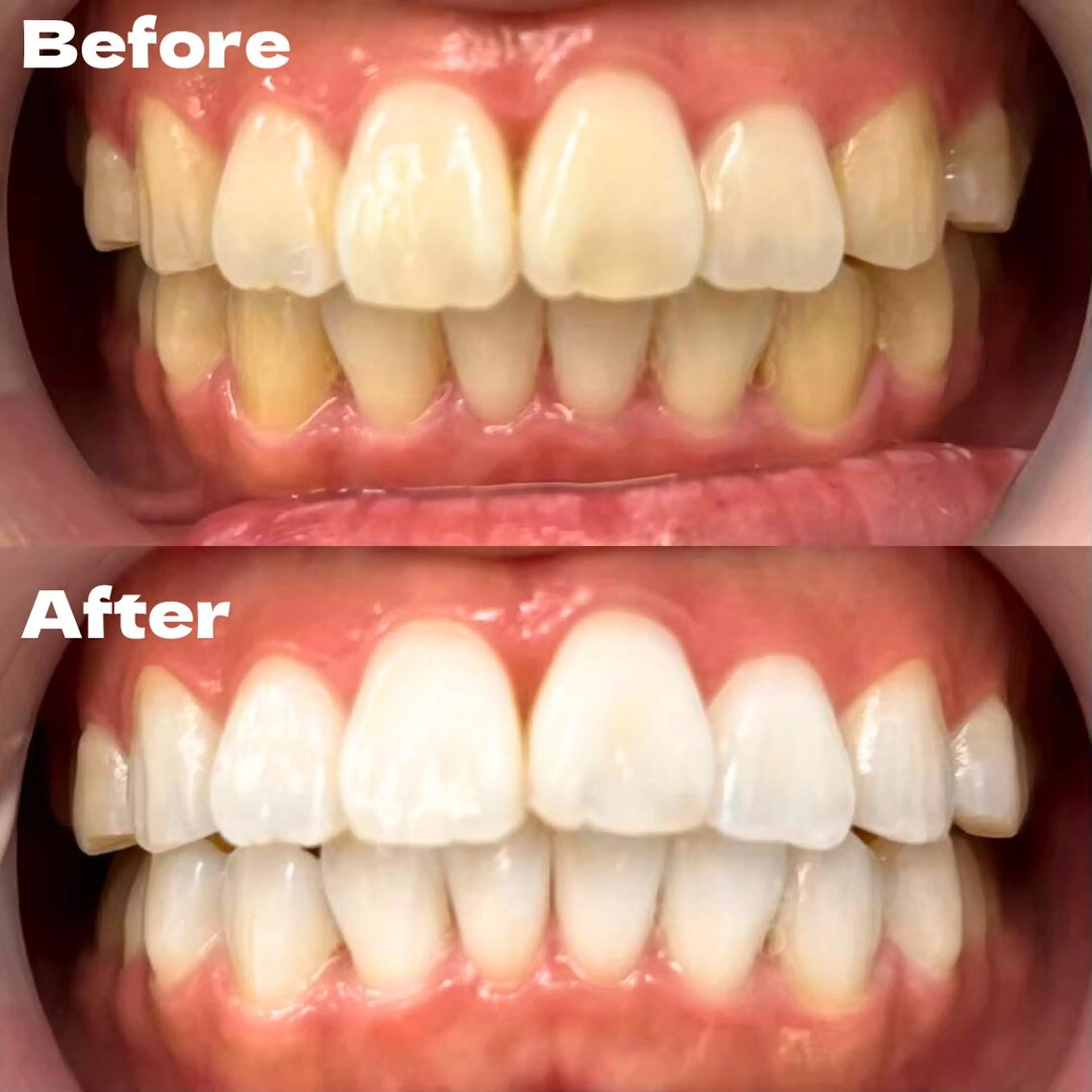 その他 LBSホワイトニング 銀座店💎公式のその他イメージ