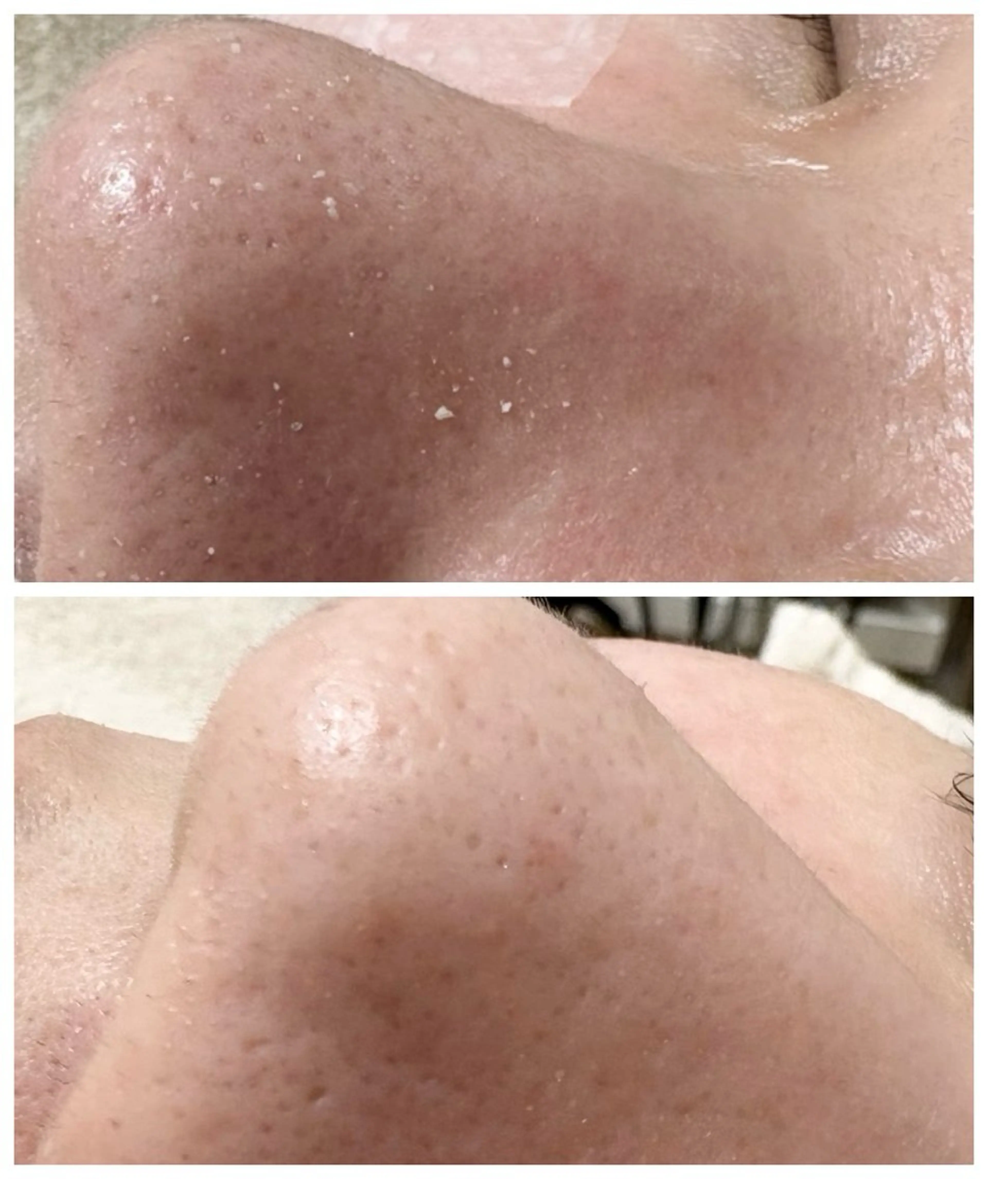 エステルーム ラティア所属・今井 登美子のエステ・リラクイメージ