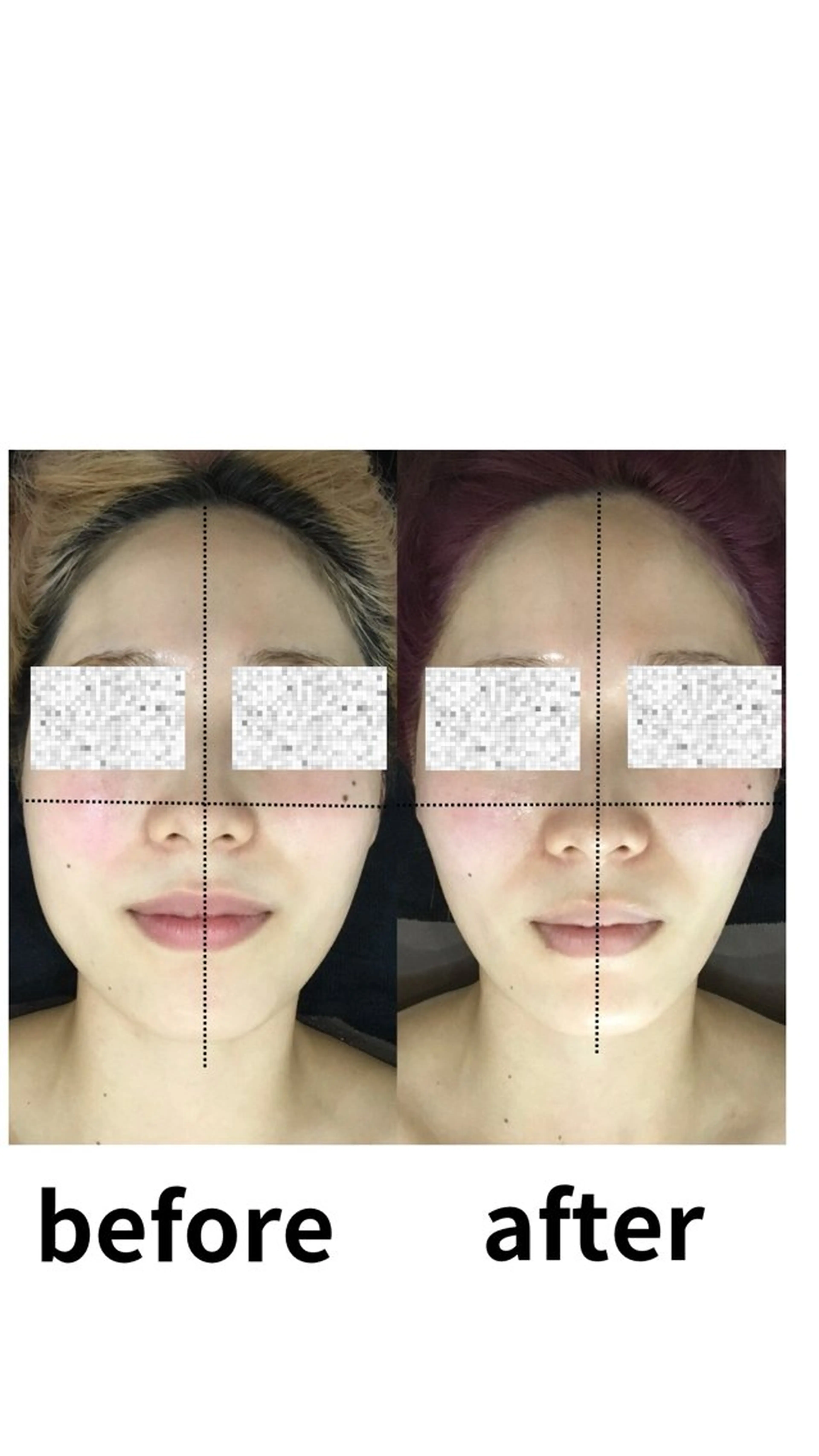 エステ リラク 小顔コルギ💎 ABBY SANOのエステ・リラクイメージ