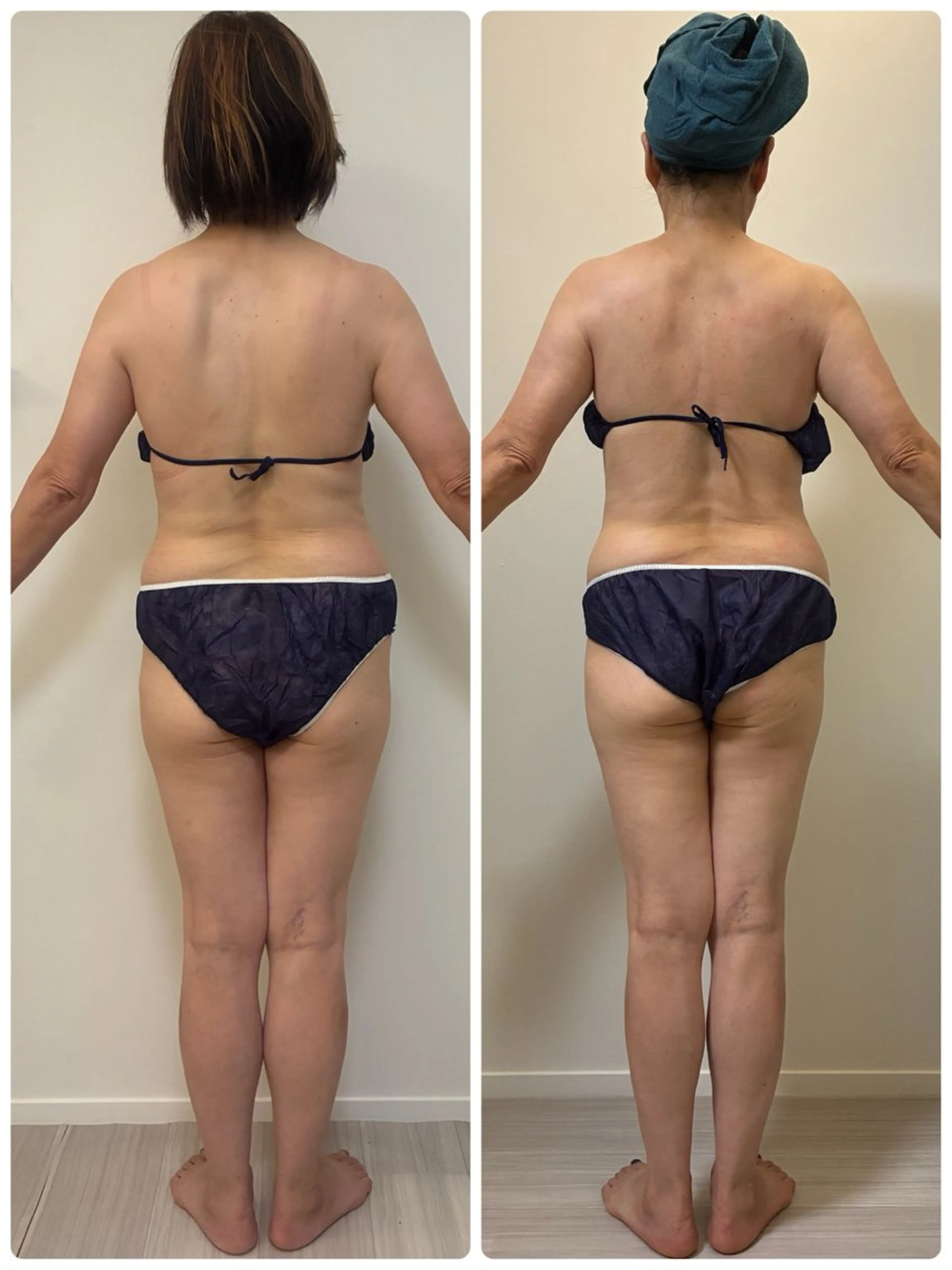 エステ デトックス×ボディメンテナンスサロンShikhara（シカラ）所属・オールハンド筋膜痩身 整体/小顔　中山朝美のエステ・リラクイメージ