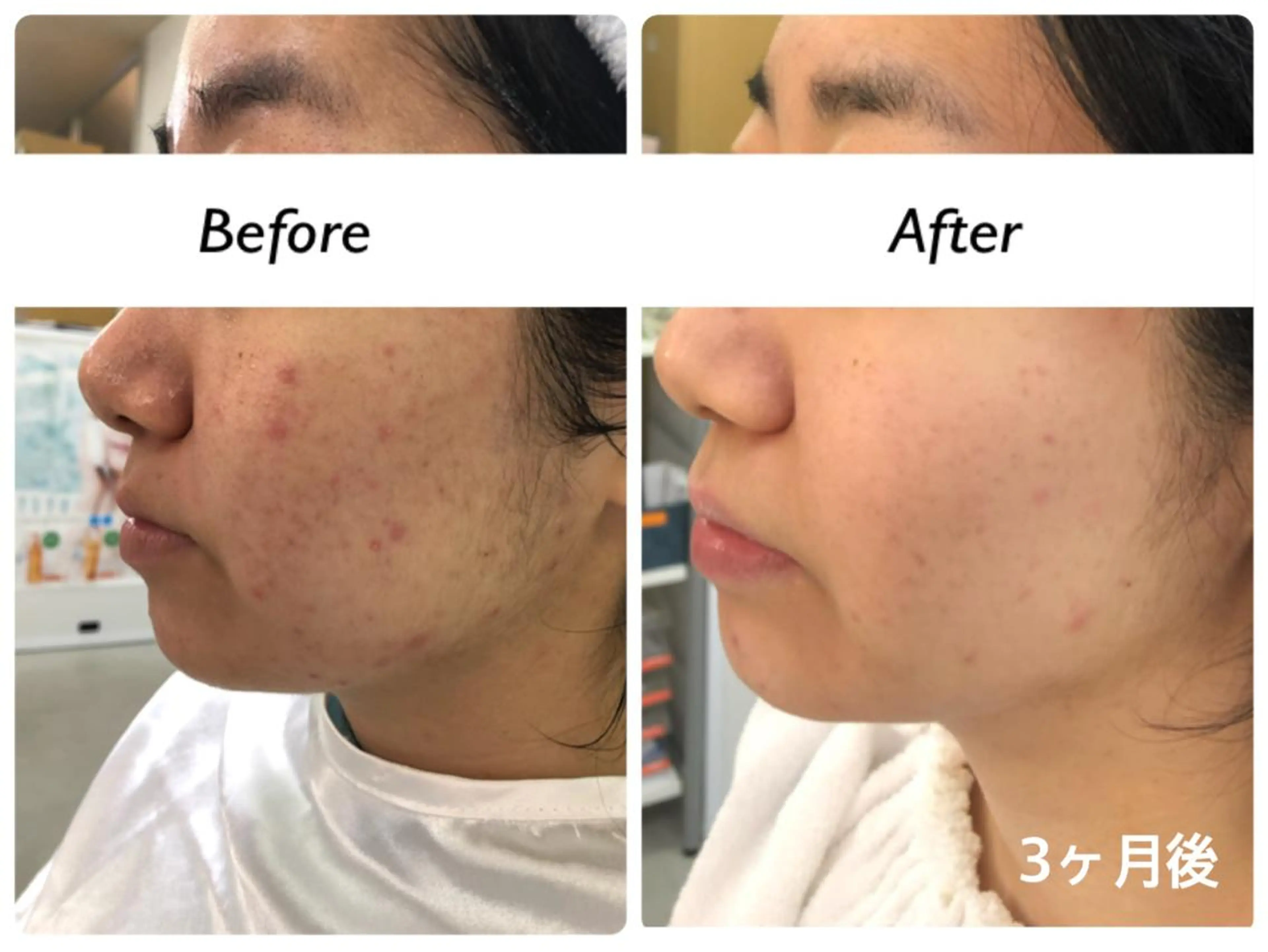 エステ 肌育成サロンcoco.A(ココアンジュ)所属・美肌コンサルタント/ 小西晴日のエステ・リラクイメージ