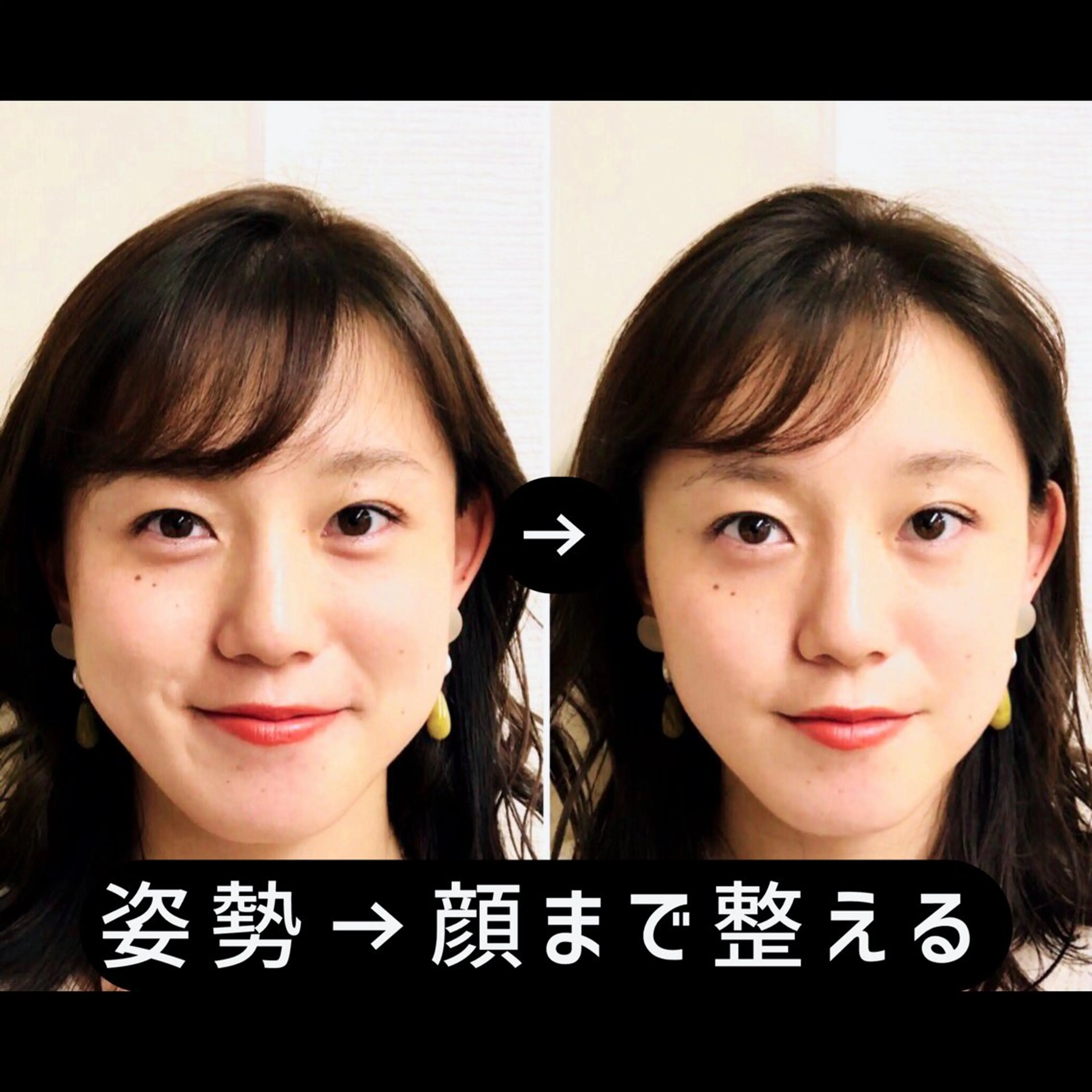 リラク 渋谷 小顔美容鍼 専門サロン YZのエステ・リラクイメージ